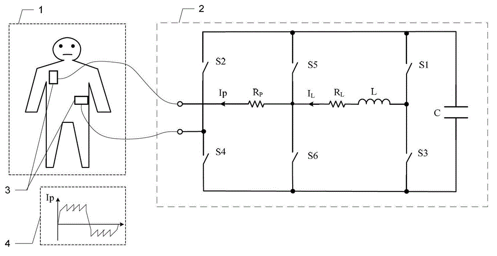 Defibrillator with extended H bridge circuit output stage and biphase sawtooth square wave high-voltage discharge method for defibrillating