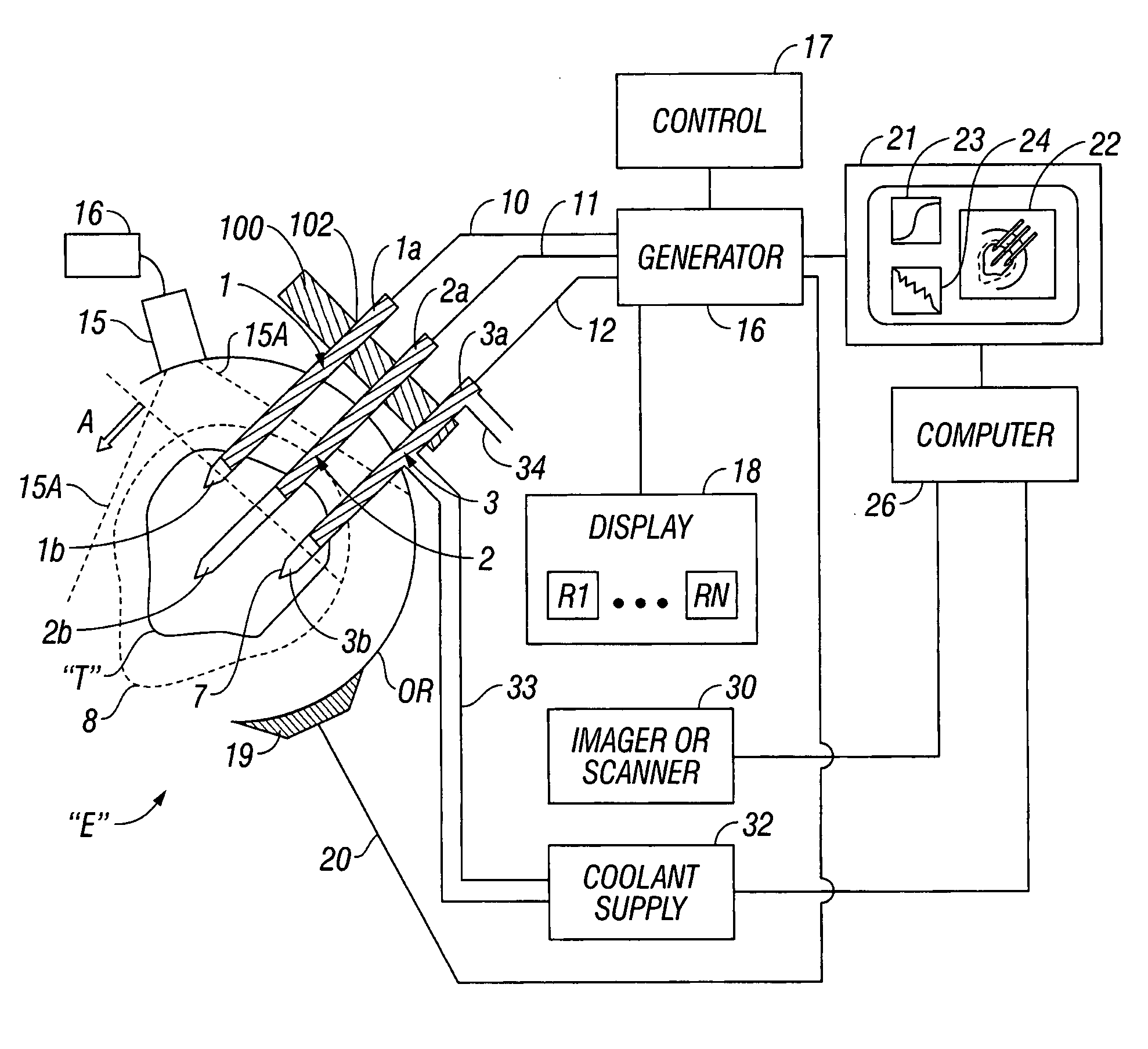 Cool-tip combined electrode introducer