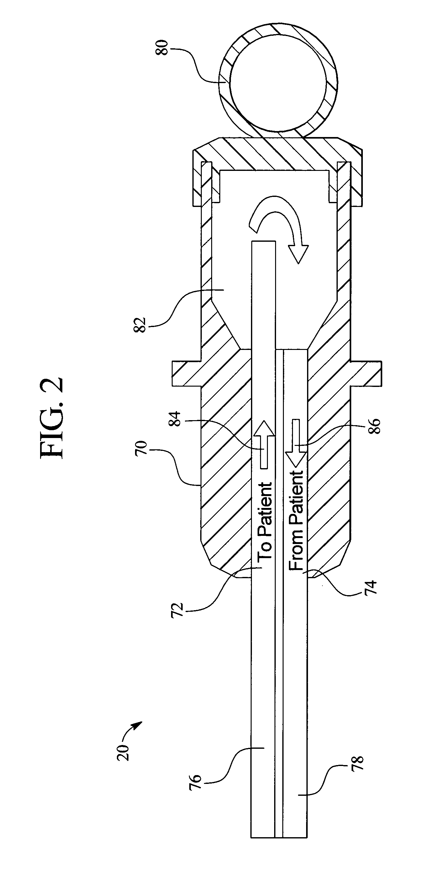 Systems and methods for performing peritoneal dialysis