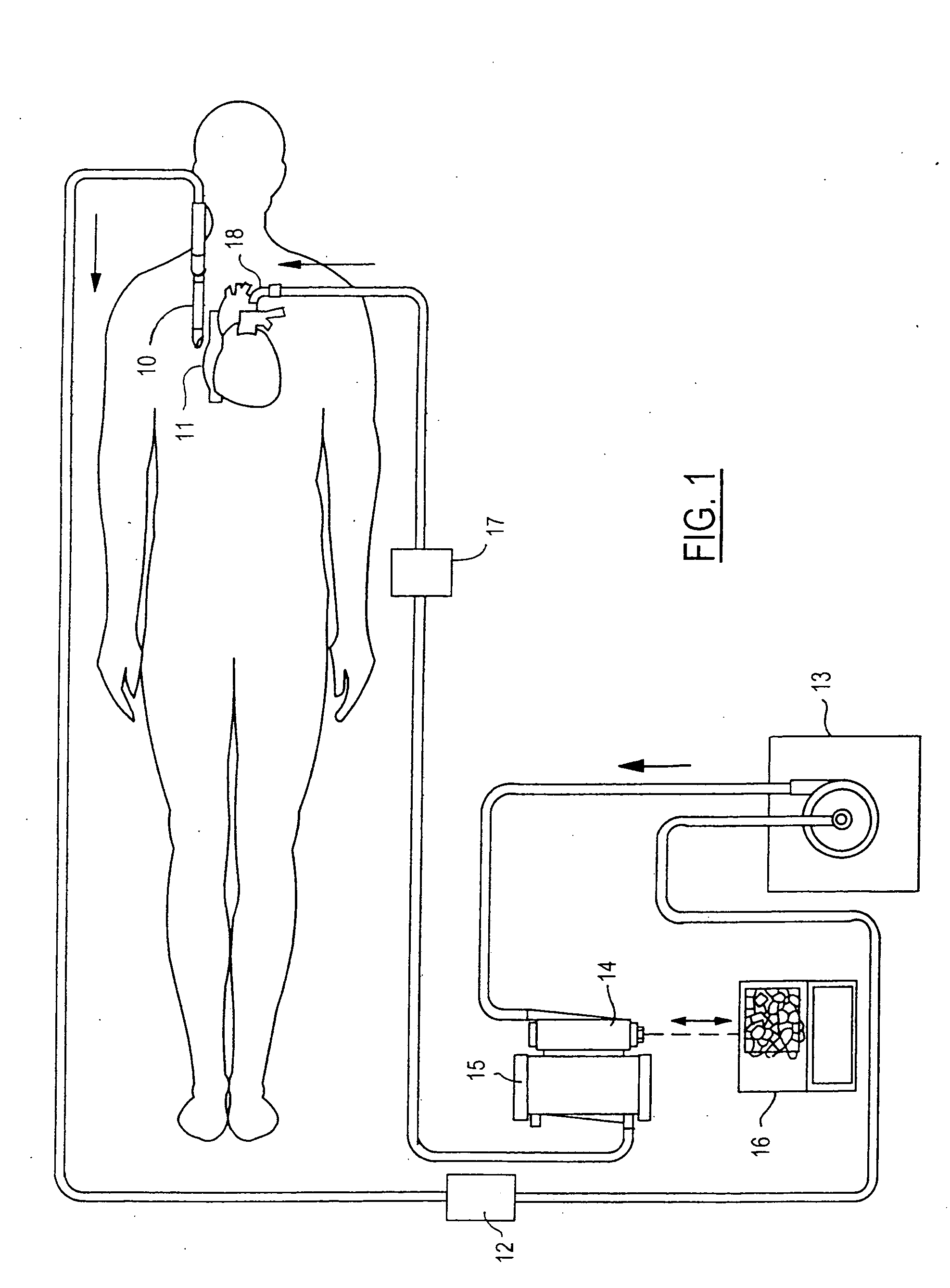 Float-driven lever arm for blood perfusion air removal device