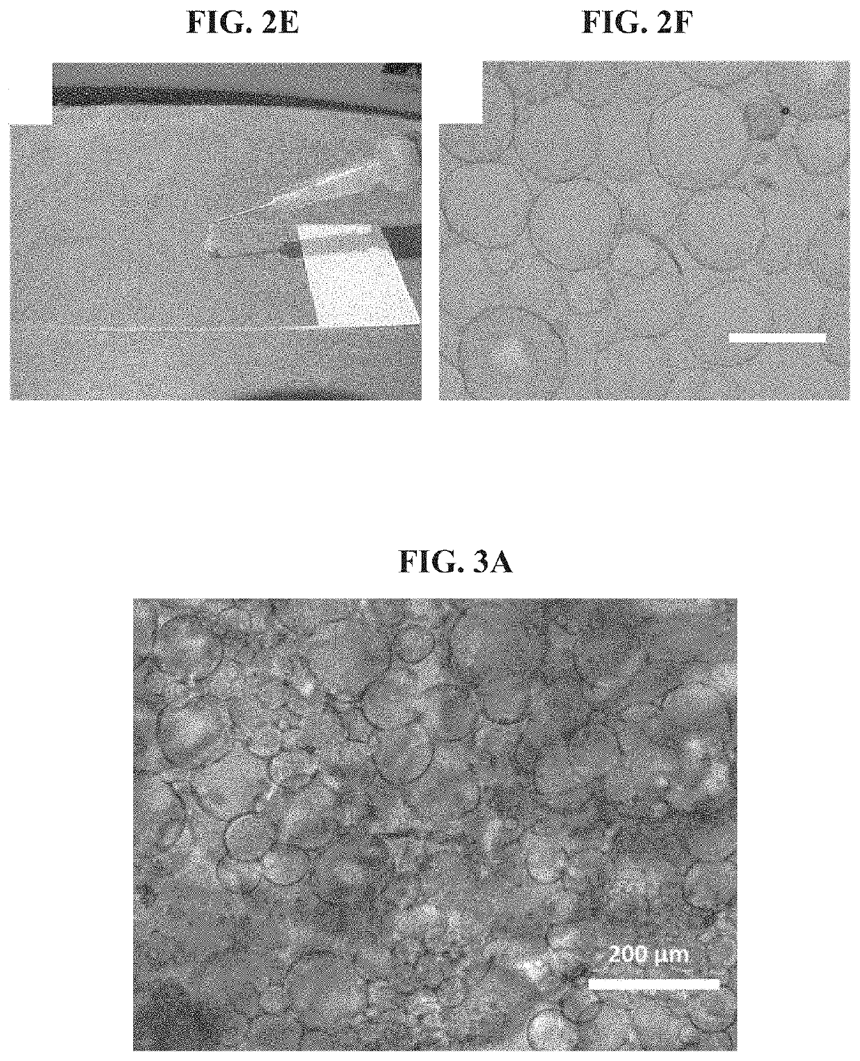 Injectable porous hydrogels