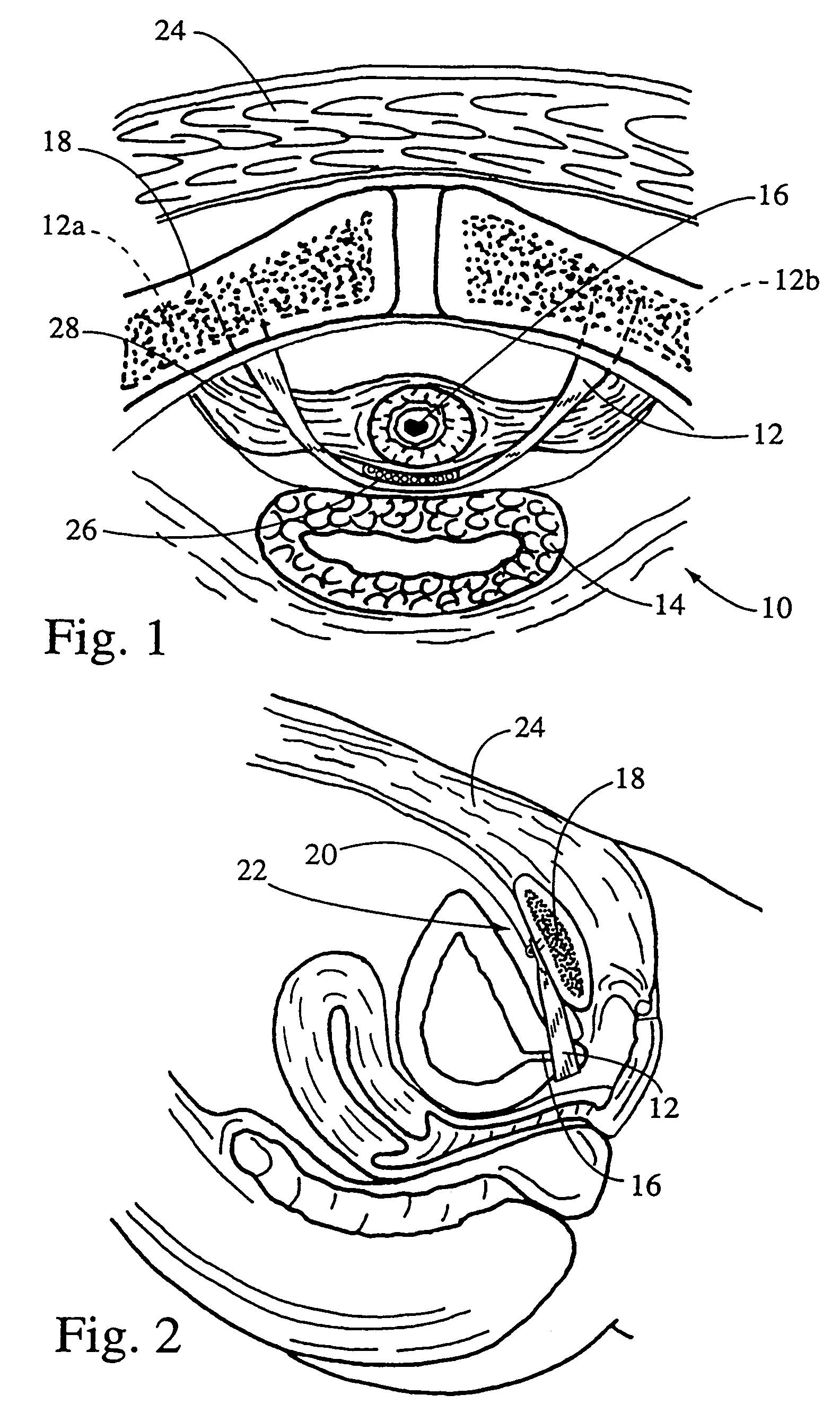 System for securing sutures, grafts and soft tissue to bone and periosteum