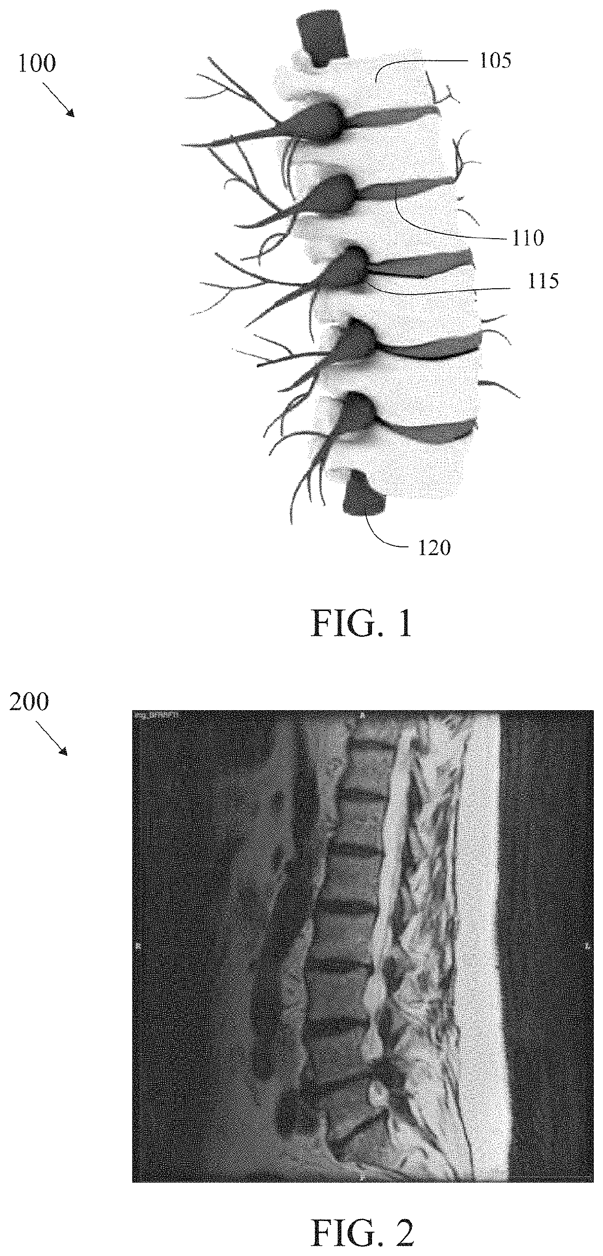 Method and system for analysis of spine anatomy and spine disease