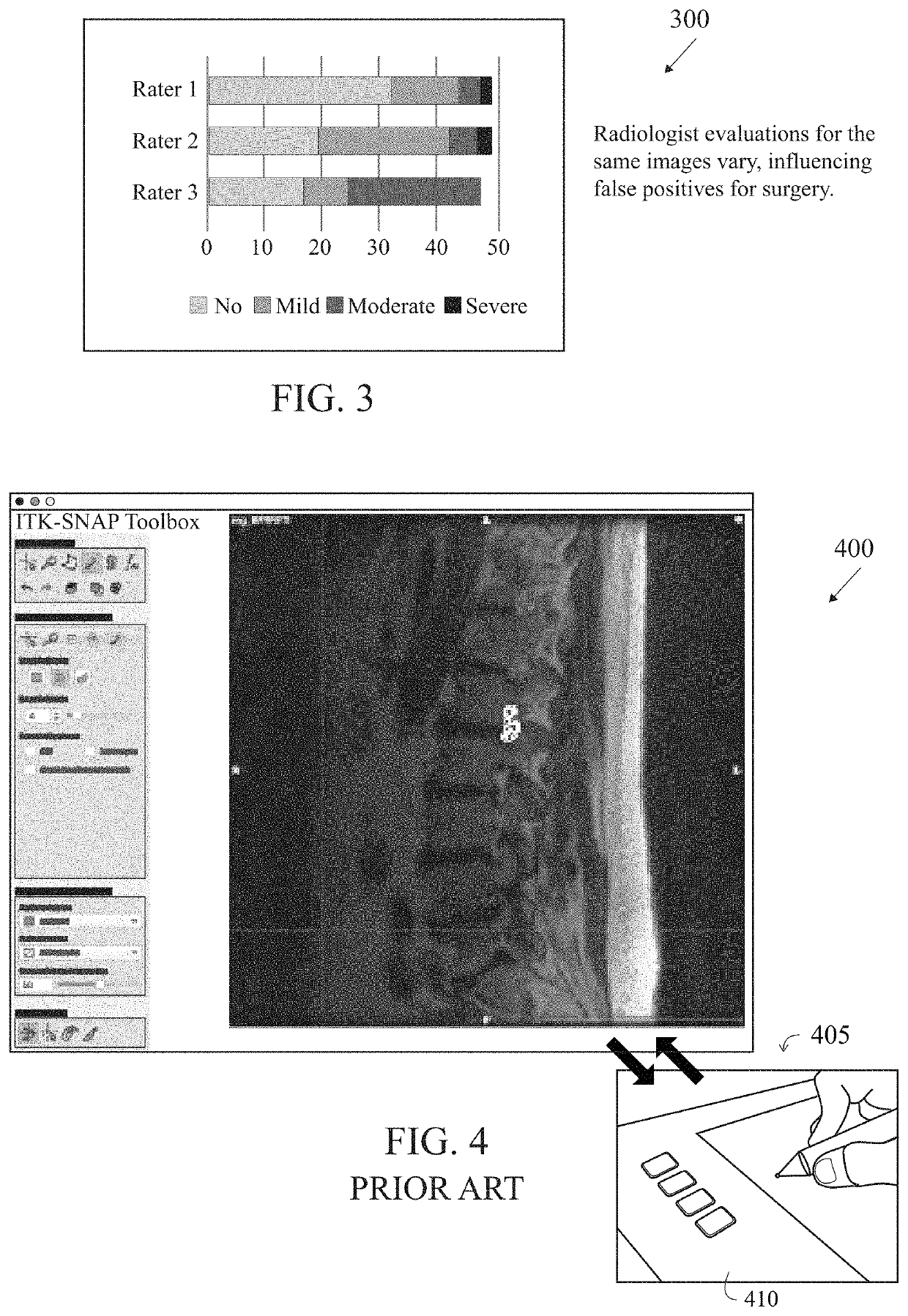 Method and system for analysis of spine anatomy and spine disease