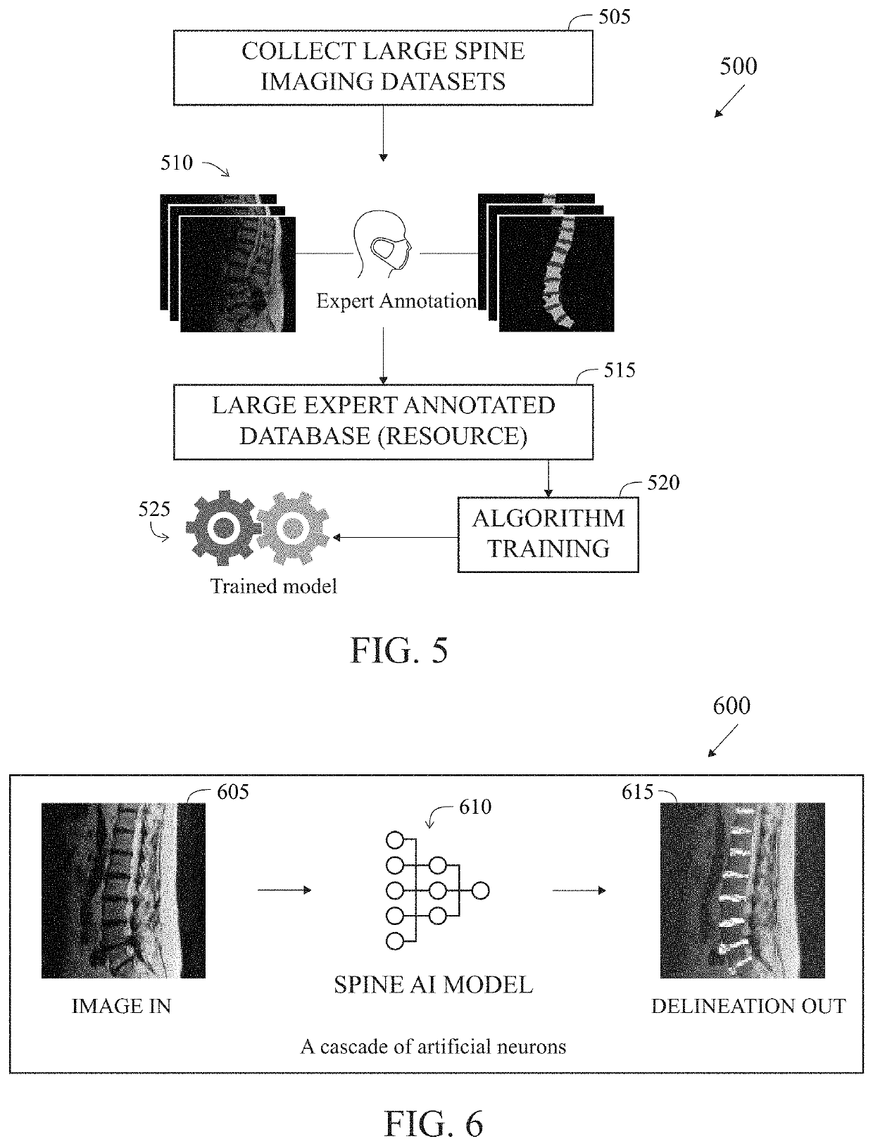 Method and system for analysis of spine anatomy and spine disease