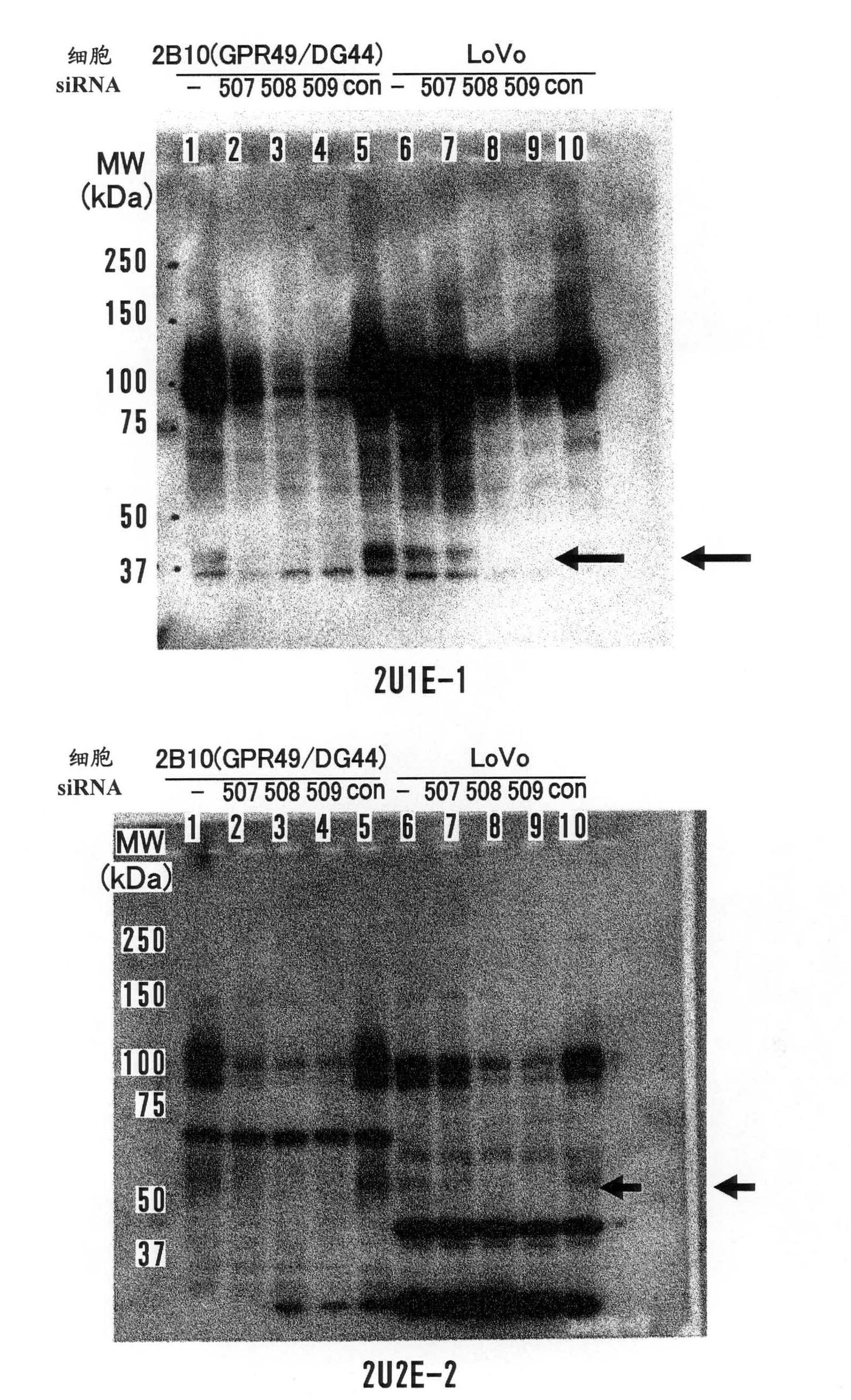 Diagnosis and treatment of cancer using anti-GPR49 antibody