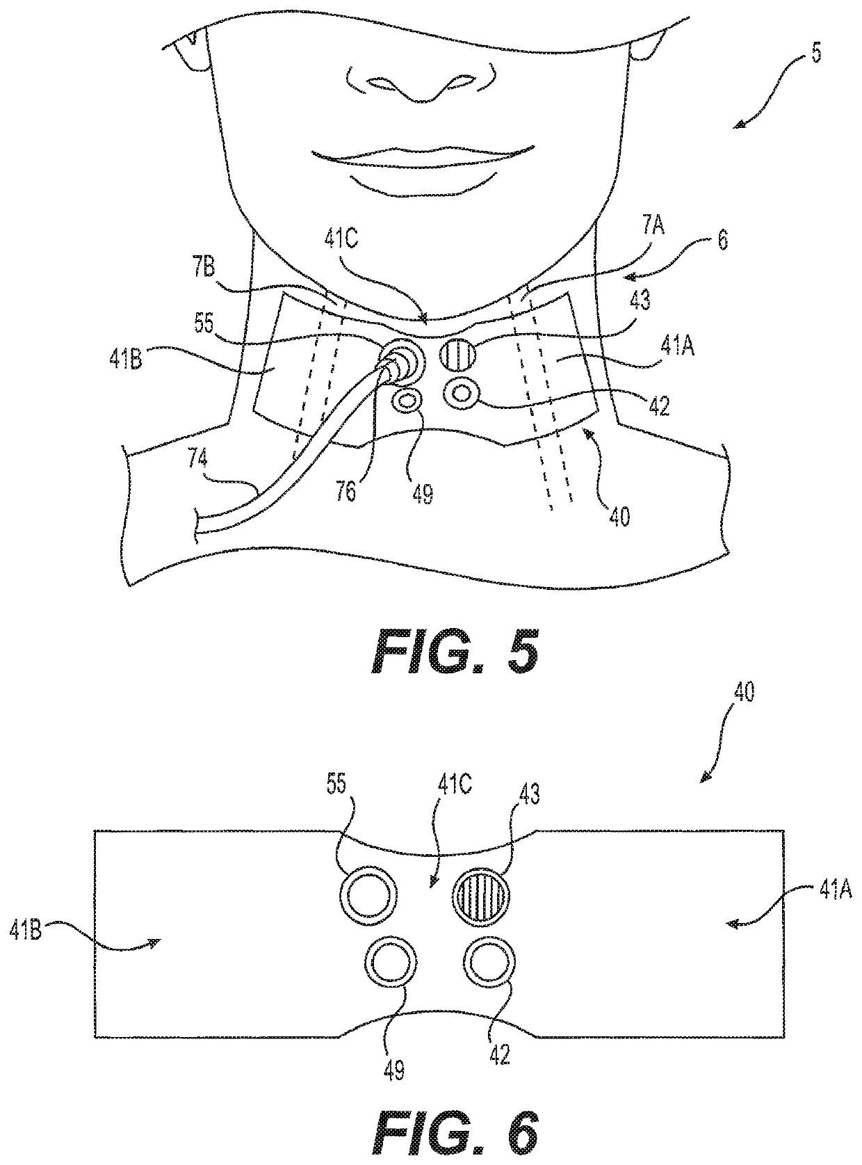 Stand-alone continuous cardiac doppler pulse monitoring patch with integral visual and auditory alerts, and patch-display system and method