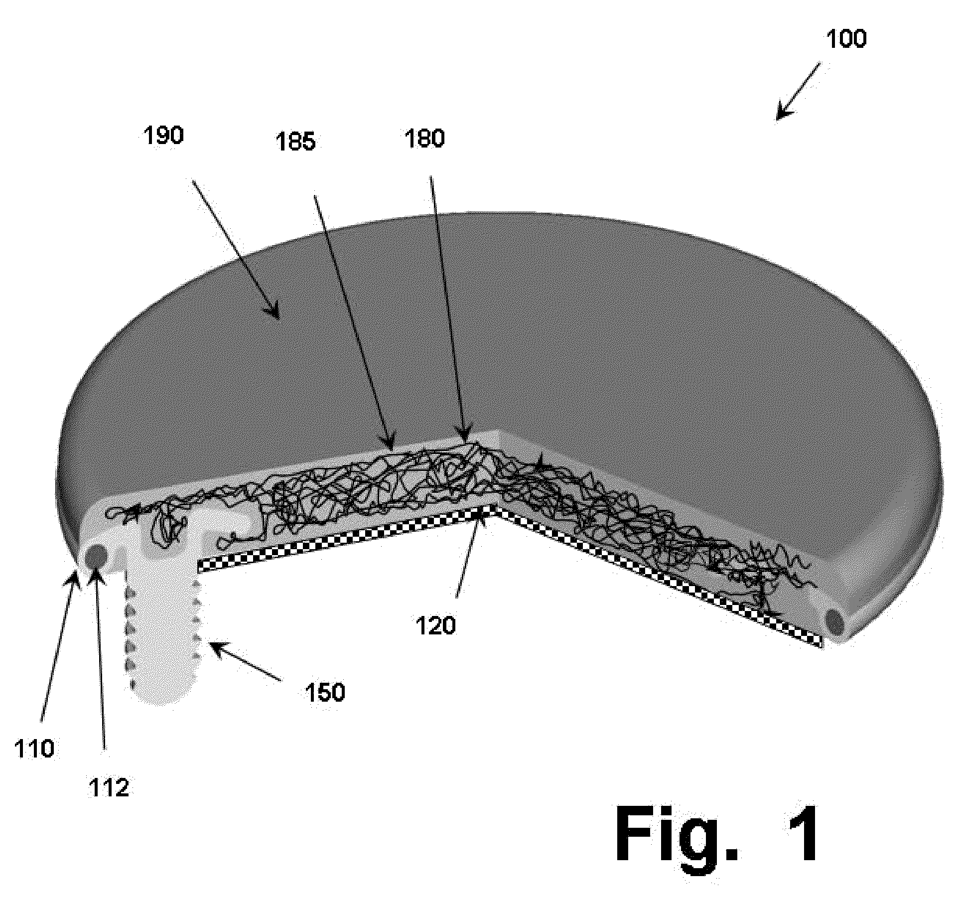 Anchoring systems and interfaces for flexible surgical implants for replacing cartilage