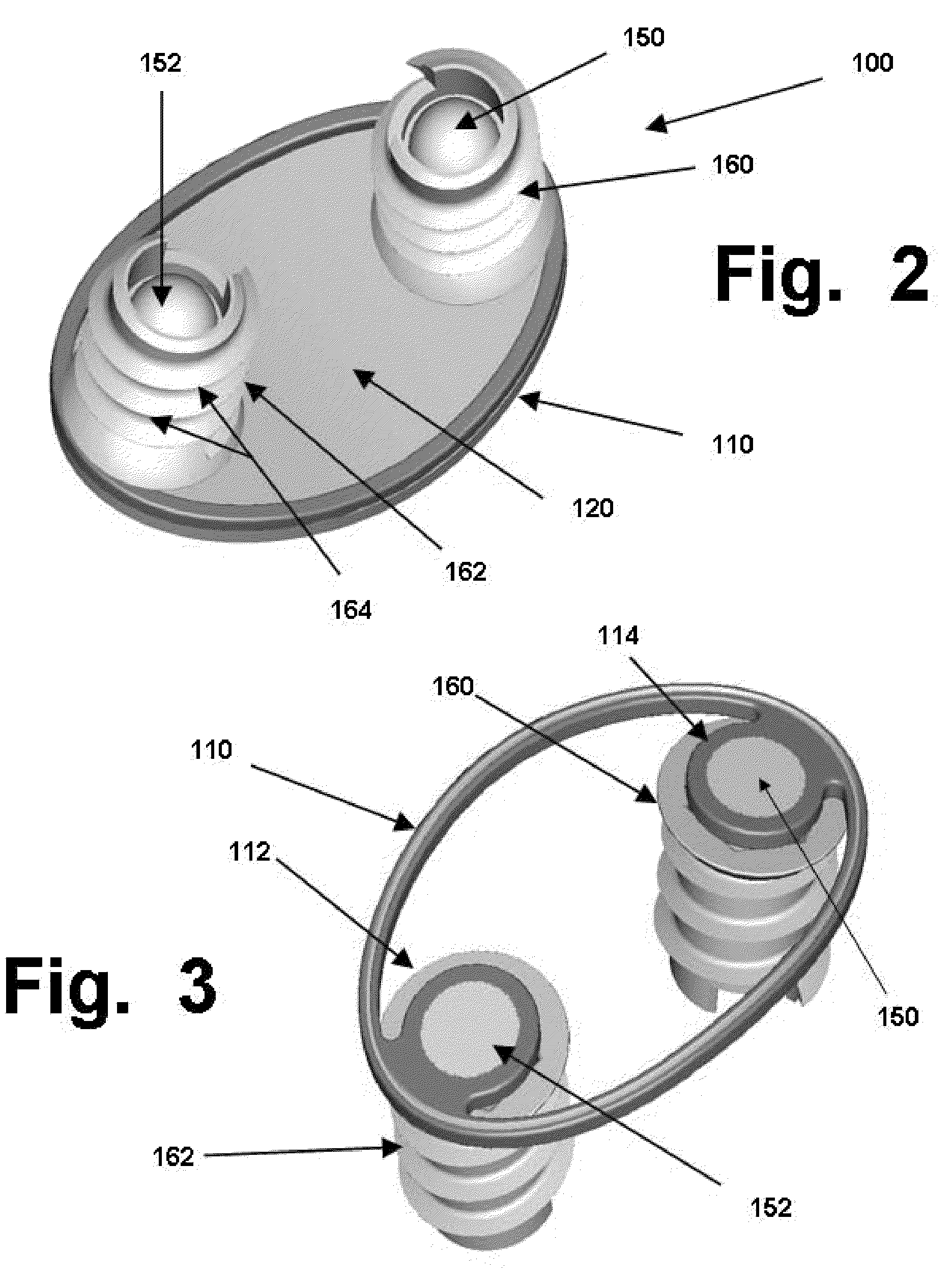 Anchoring systems and interfaces for flexible surgical implants for replacing cartilage