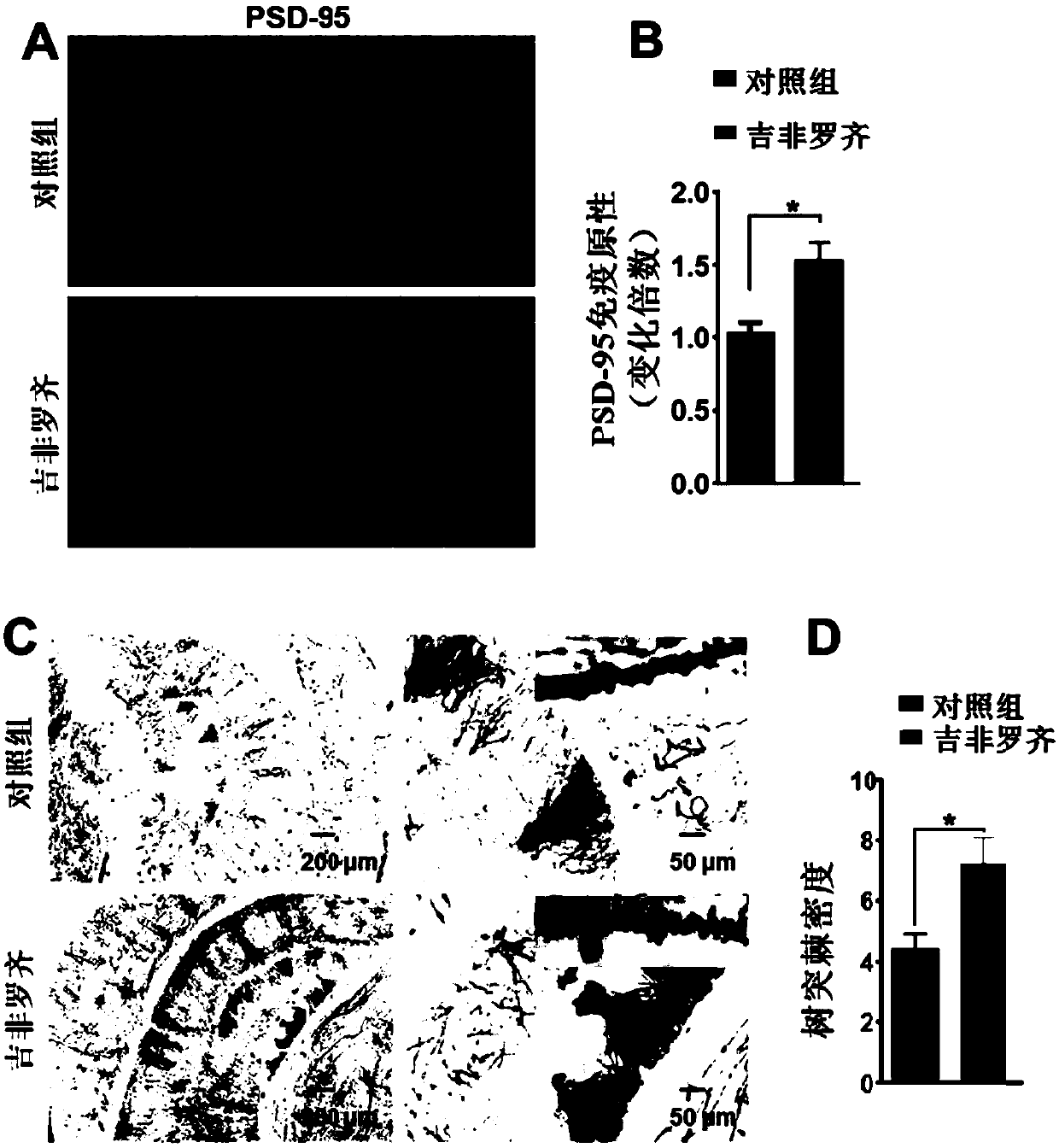 Application of gemfibrozil and derivatives thereof for treating and/or preventing neurodegenerative diseases