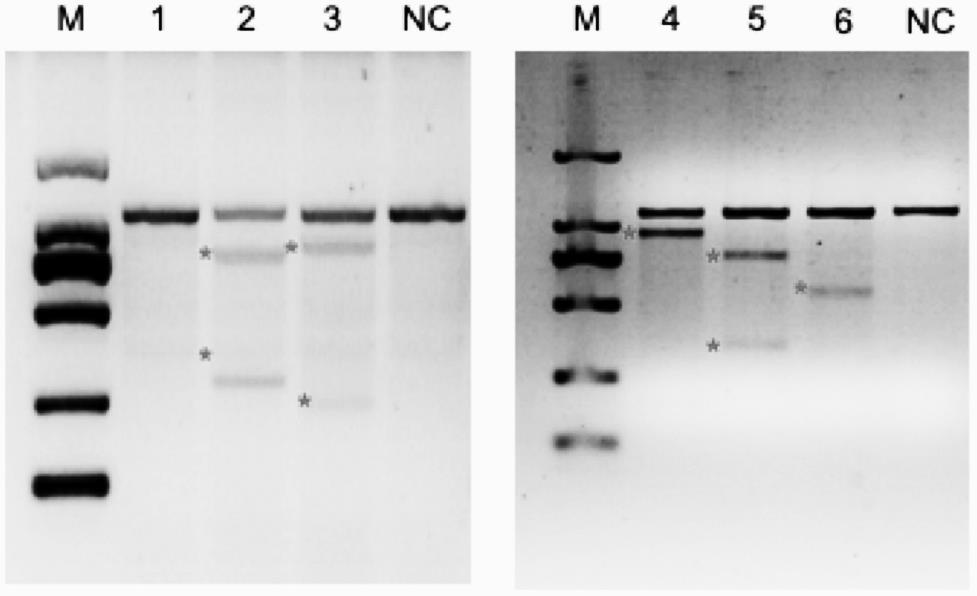 A kind of preparation method of rosa26 site-directed knock-in human complement regulatory protein minipig