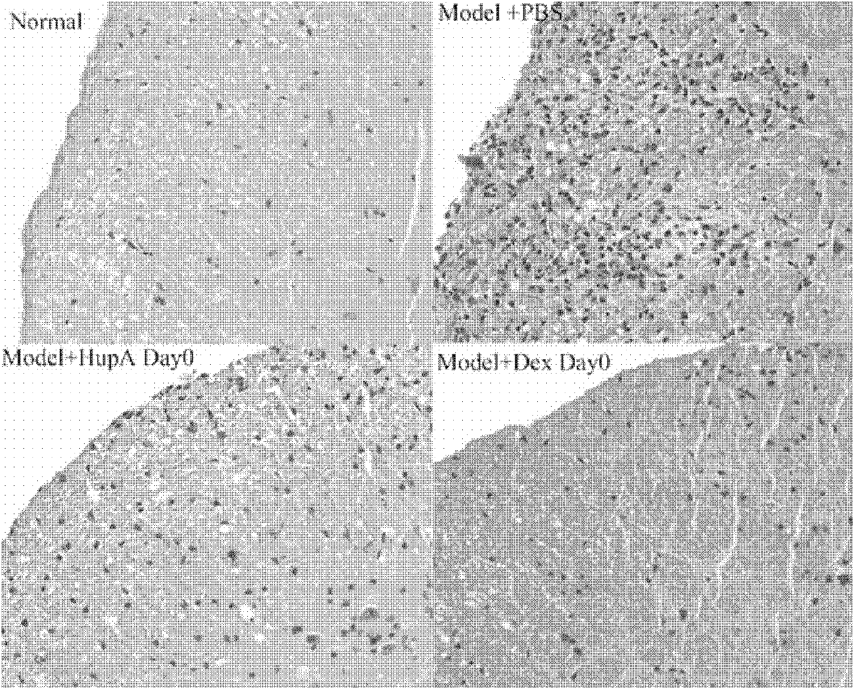 Application of Huperzine A in preparation of medicines preventing and treating multiple sclerosis disease