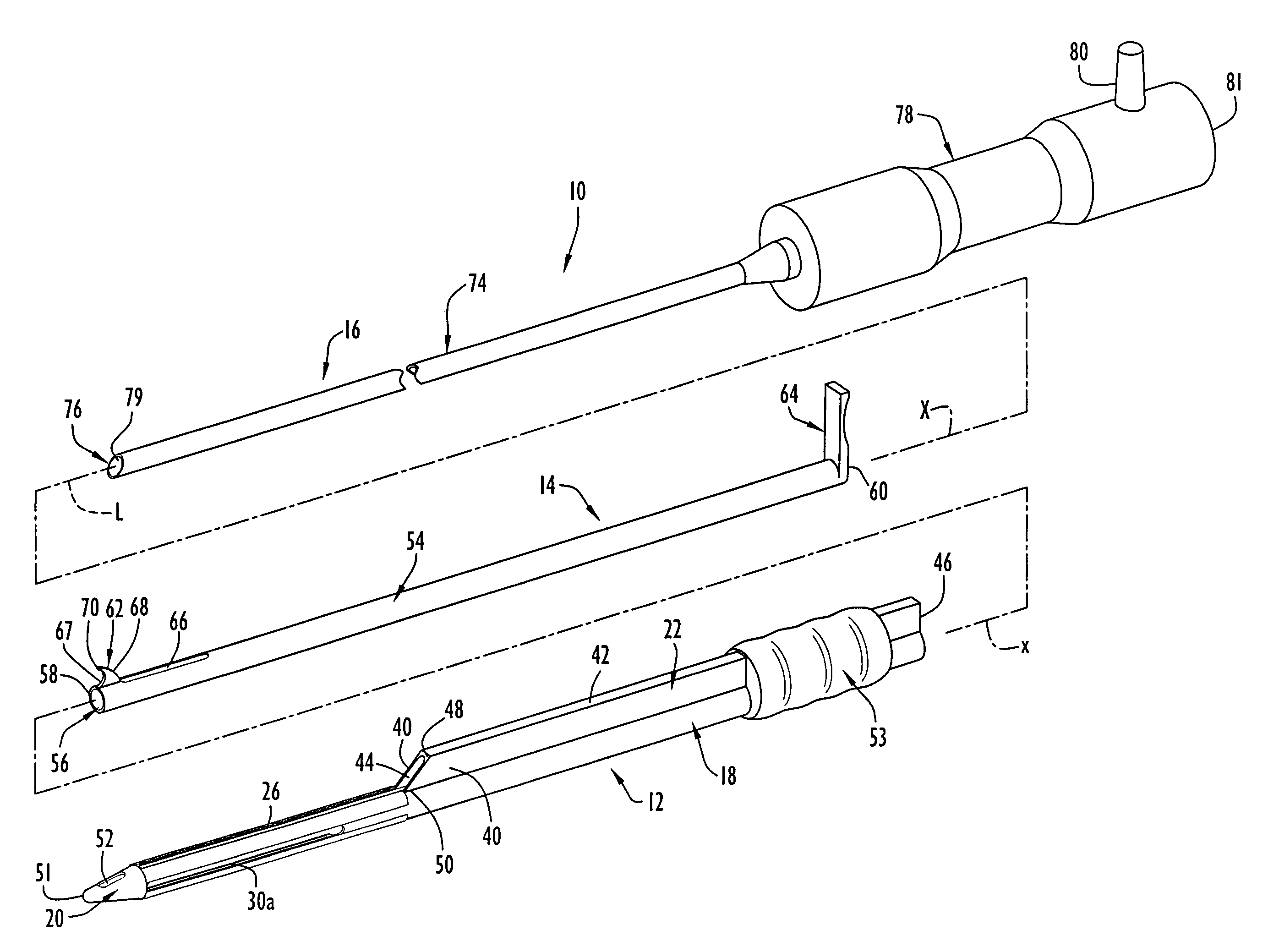 Instruments and method for minimally invasive carpal tunnel release
