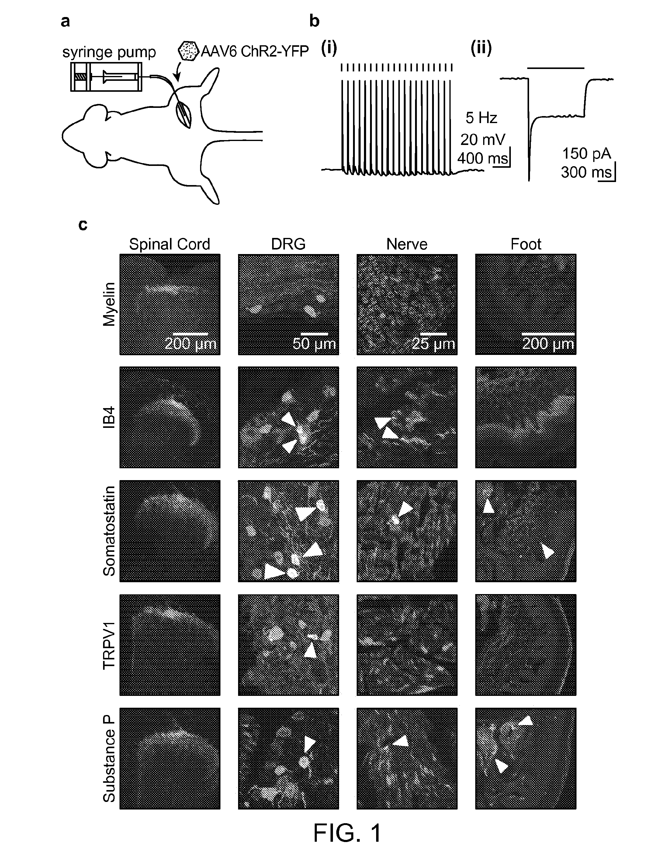 Compositions and methods for controlling pain