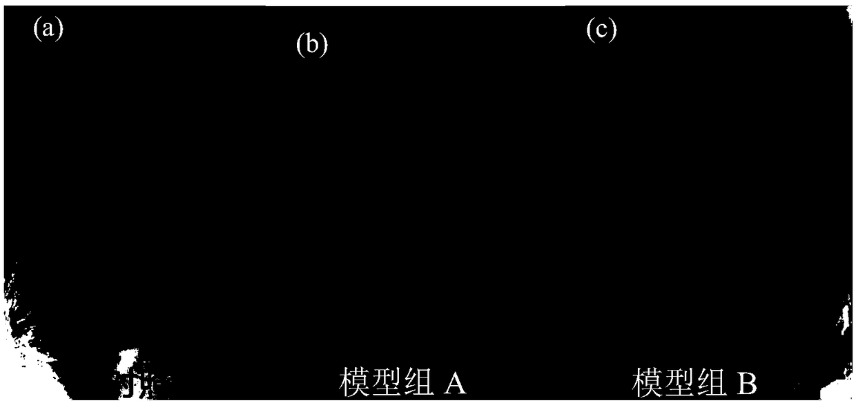 Preparation method of purpura lapillus anti-inflammatory extract, and application thereof in anti-acne medicine