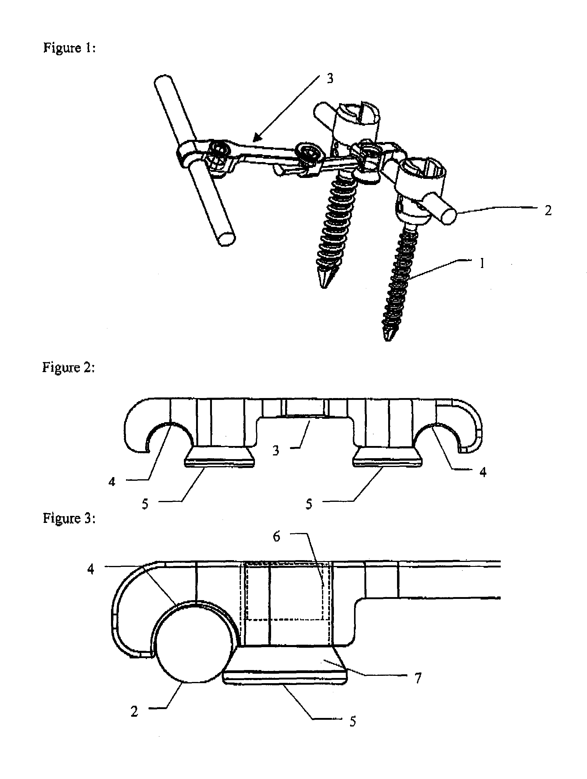 Transverse connector system