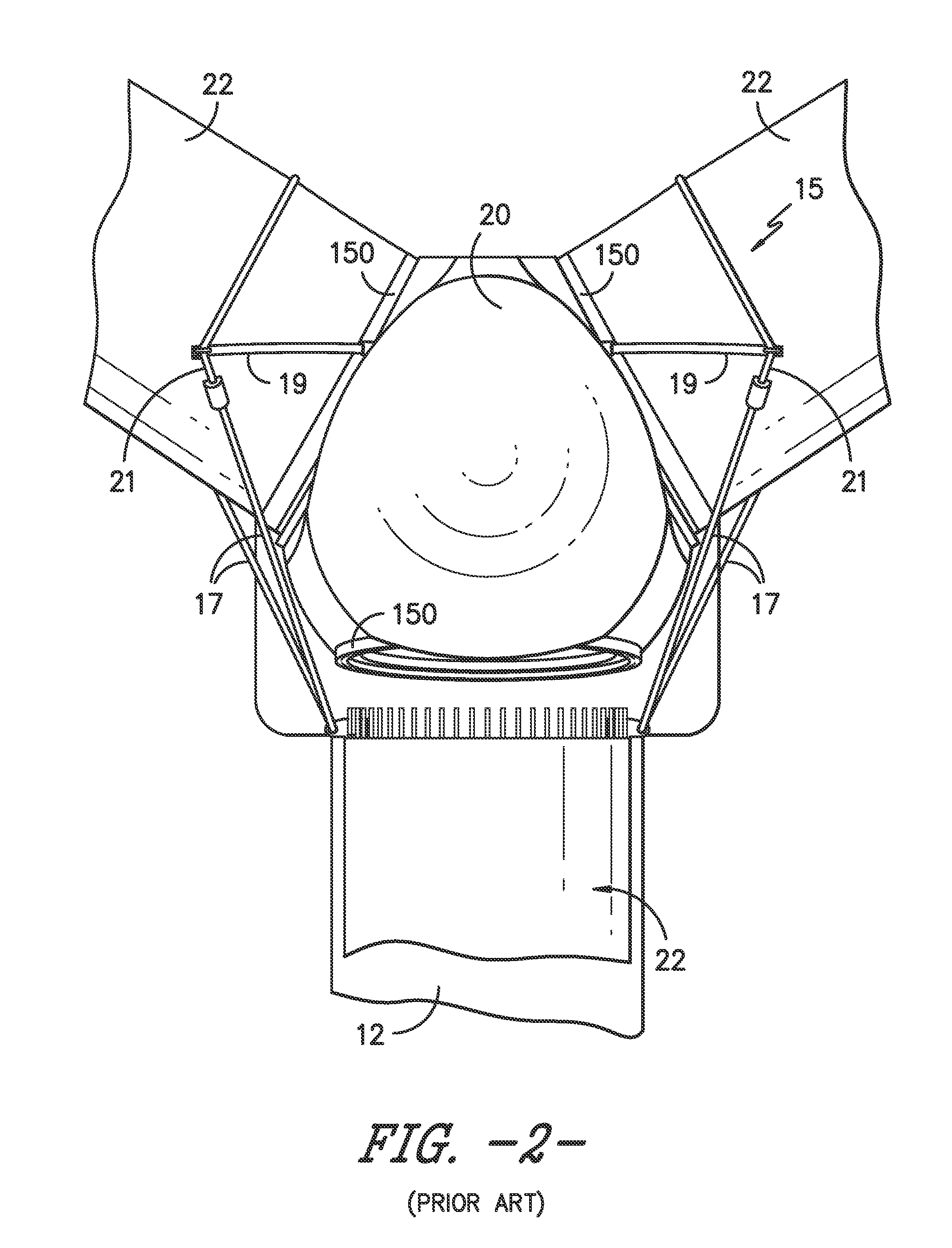 Up-tower suspension system for a wind turbine rotor blade