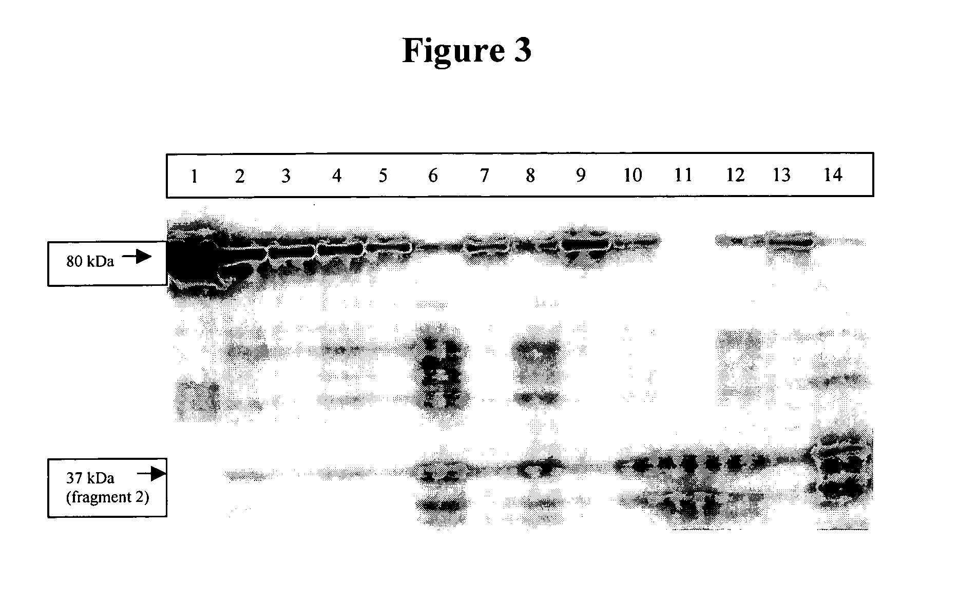 Methods and compositions for use in the diagnosis and treatment of chronic immune disease