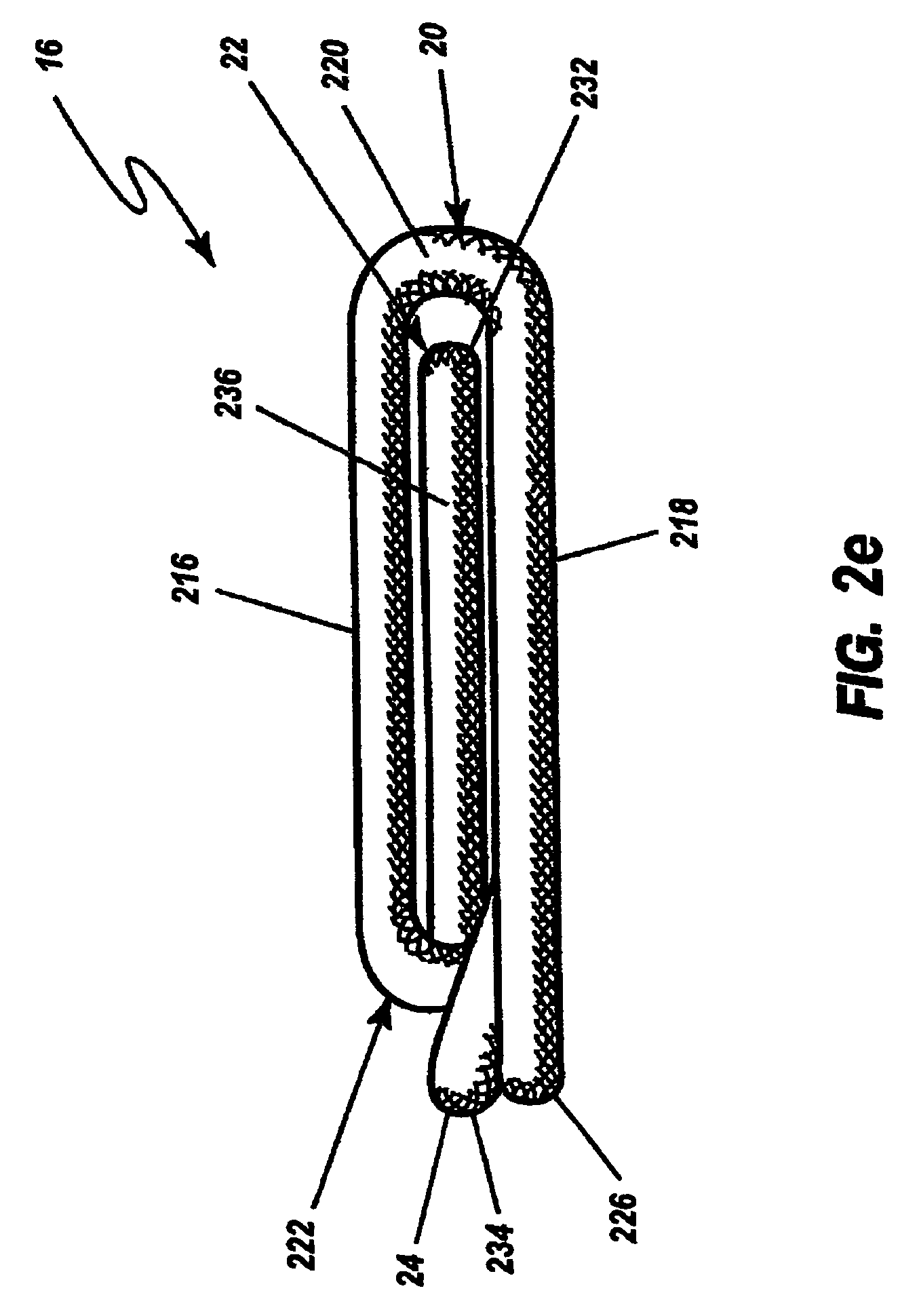 Surgical ligation clip and method for use thereof