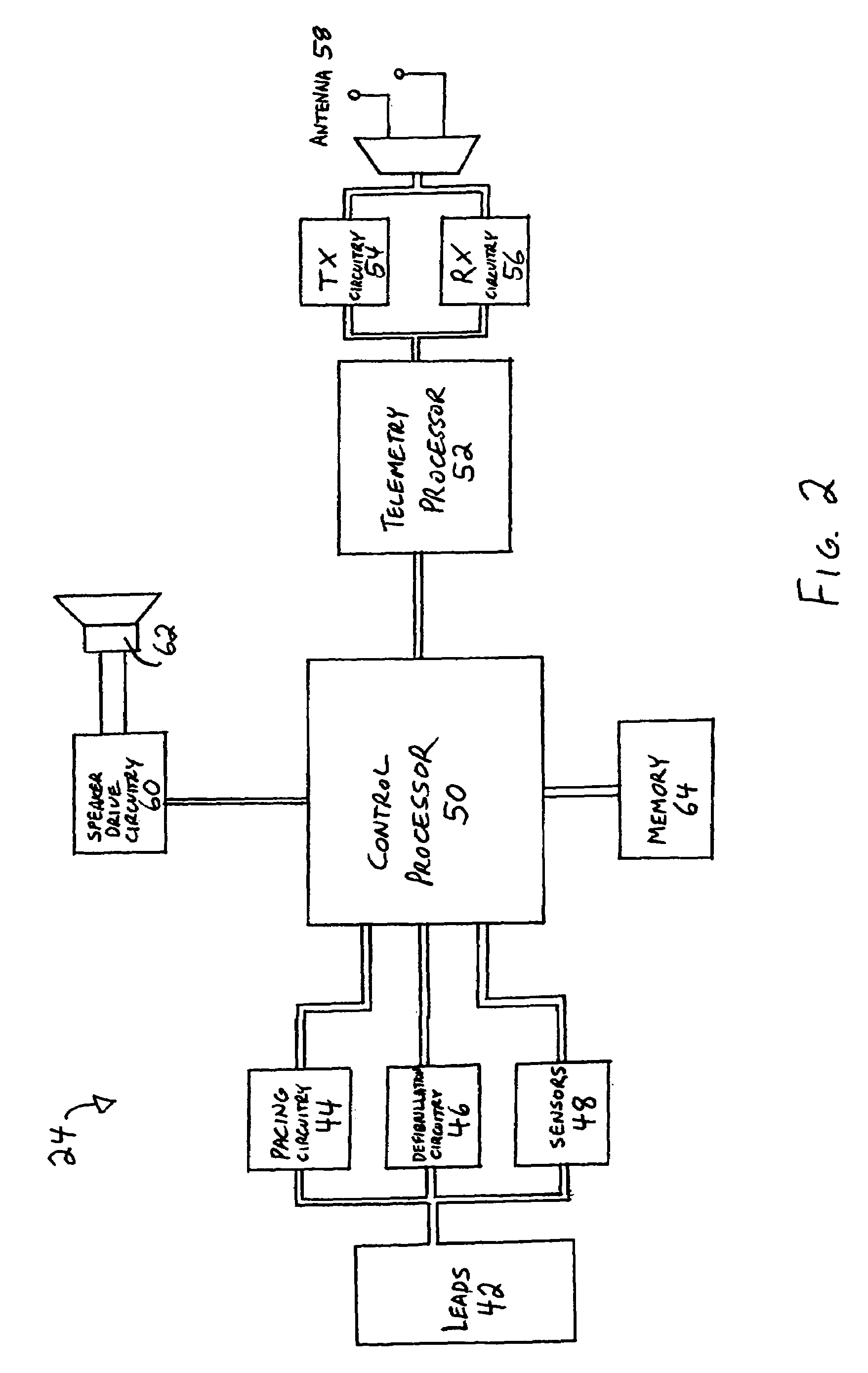 Alert system and method for an implantable medical device