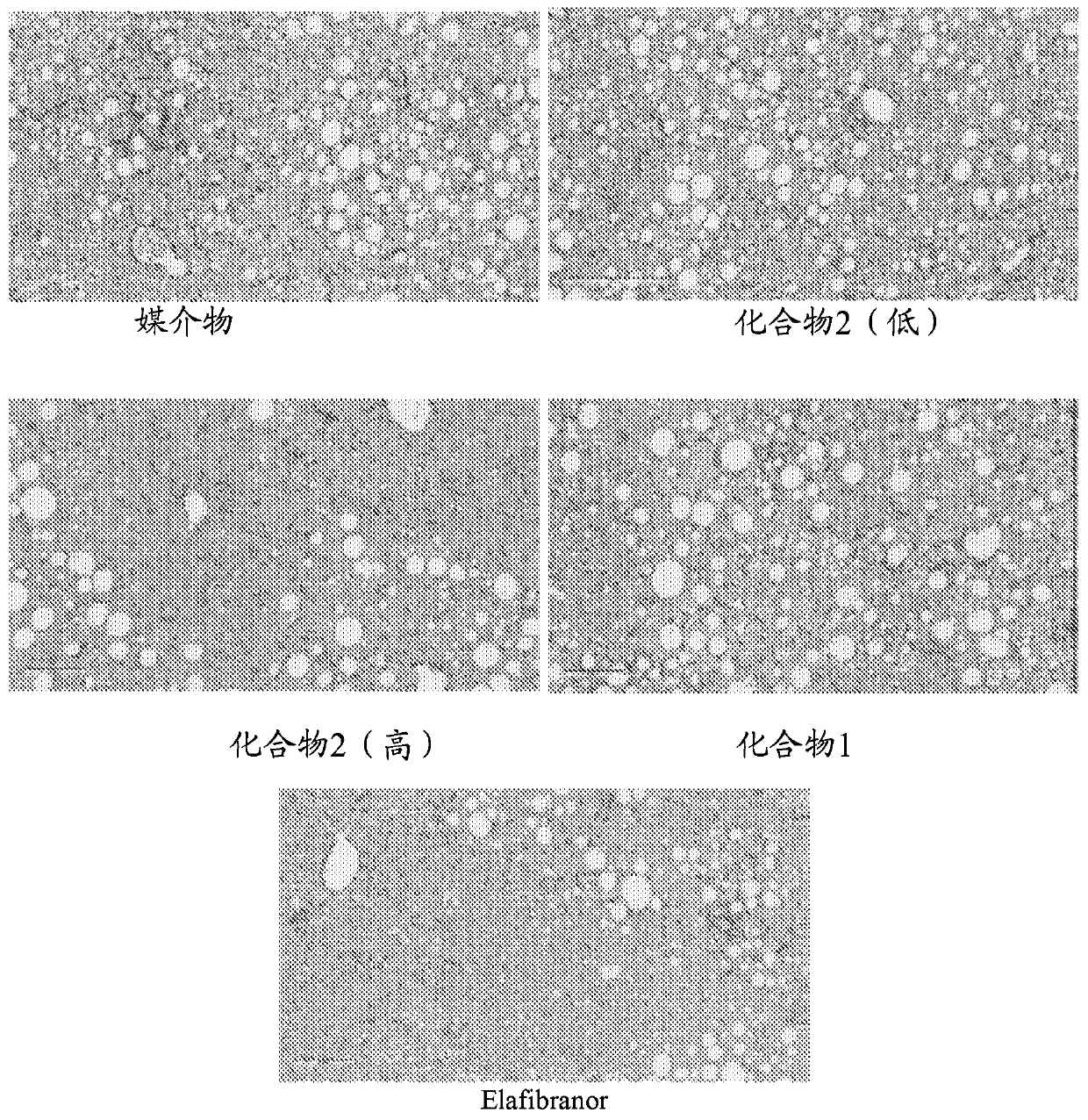 Compositions for treatment of fibrosis