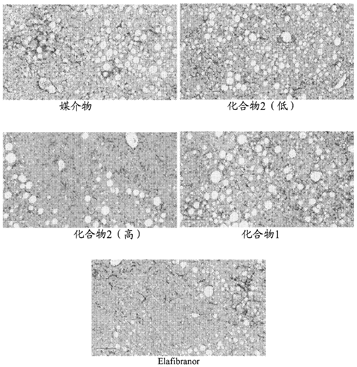 Compositions for treatment of fibrosis