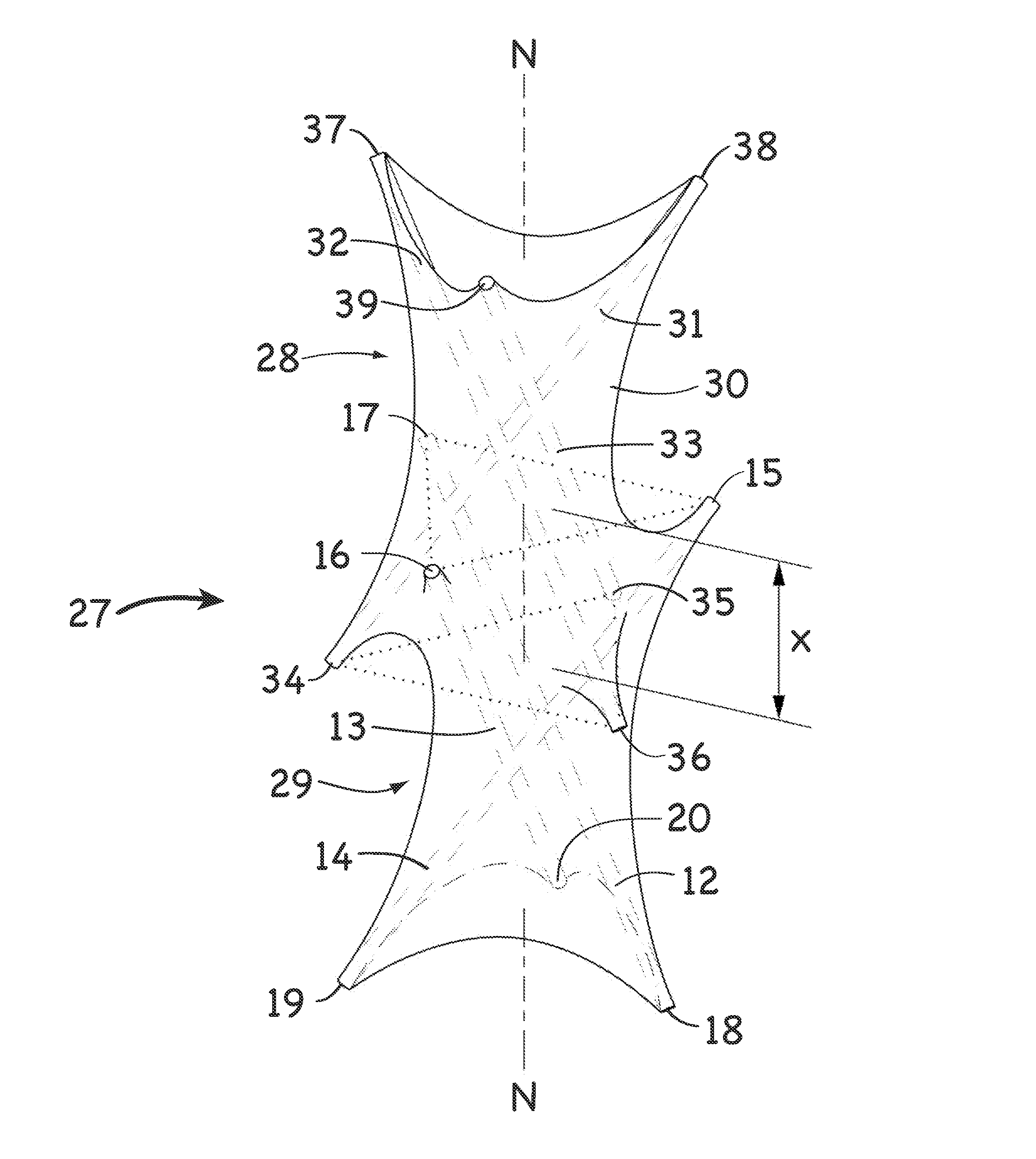 Continuous tension, discontinuous compression systems and methods