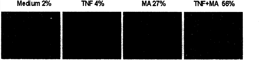 Antitumor MA-TNF alpha medicine composition and application thereof