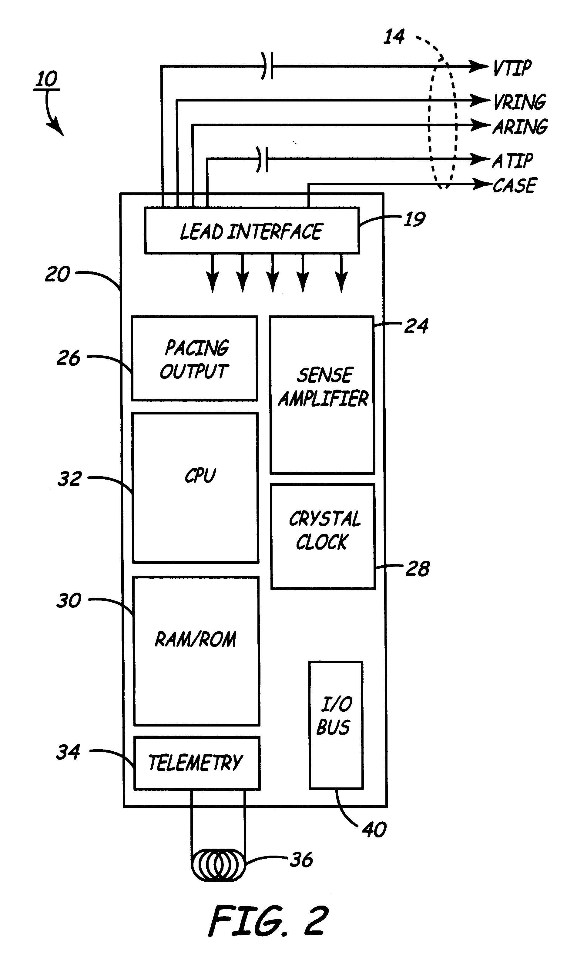 Method and apparatus for displaying information retrieved from an implanted medical device
