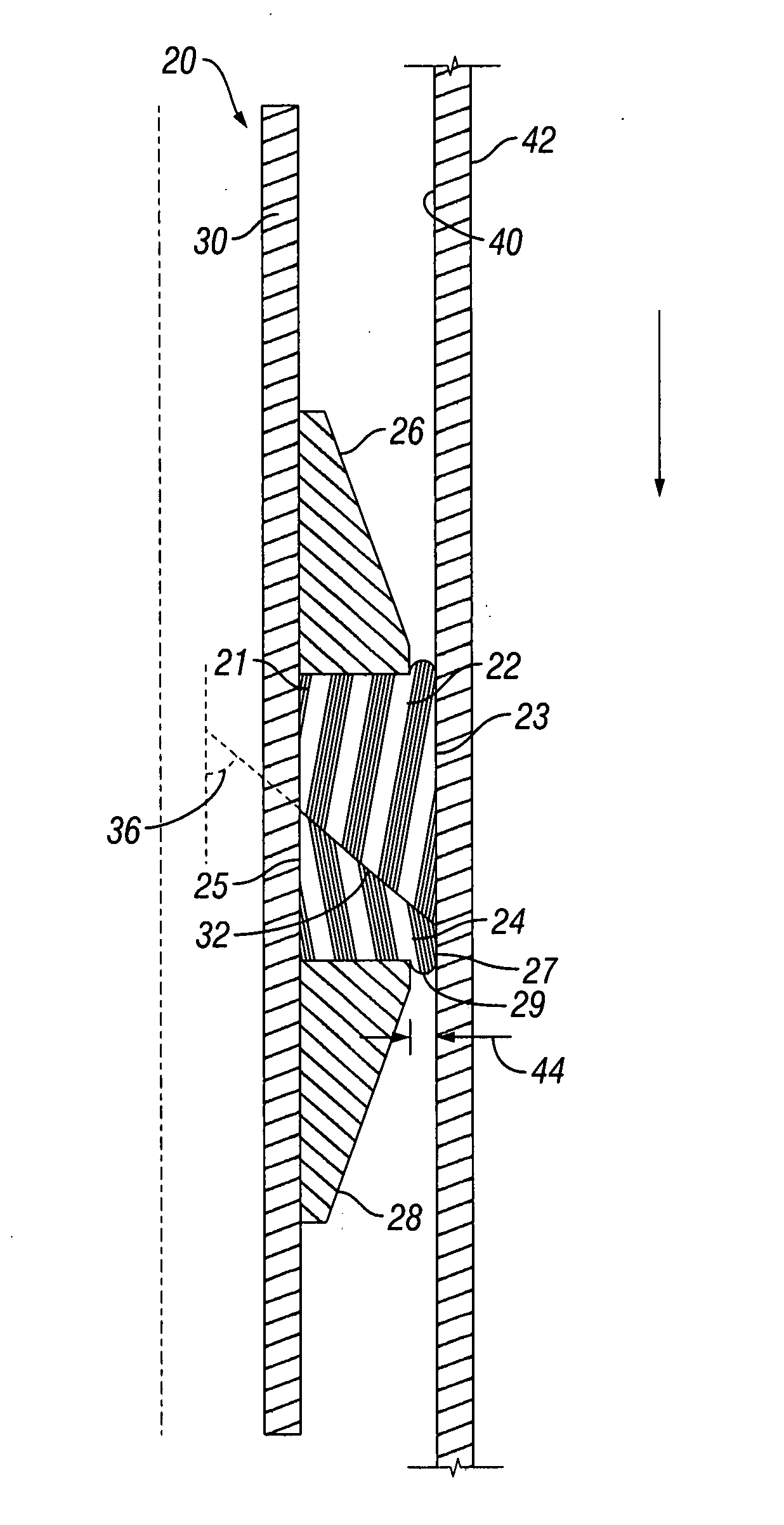 Non-backed-up packing element system