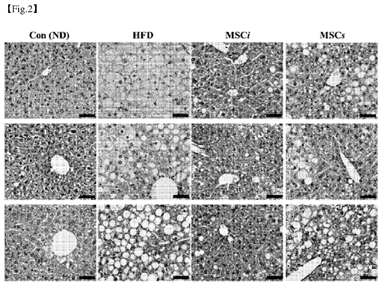 Pharmaceutical composition for preventing or treating obesity or non-alcoholic fatty liver, containing dental tissue-derived multipotent stem cells