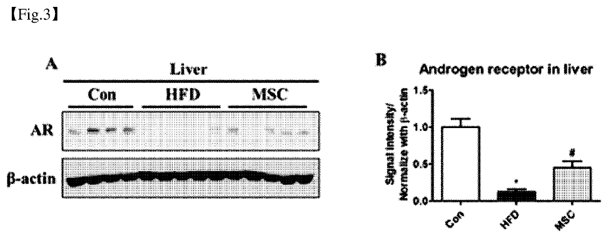 Pharmaceutical composition for preventing or treating obesity or non-alcoholic fatty liver, containing dental tissue-derived multipotent stem cells