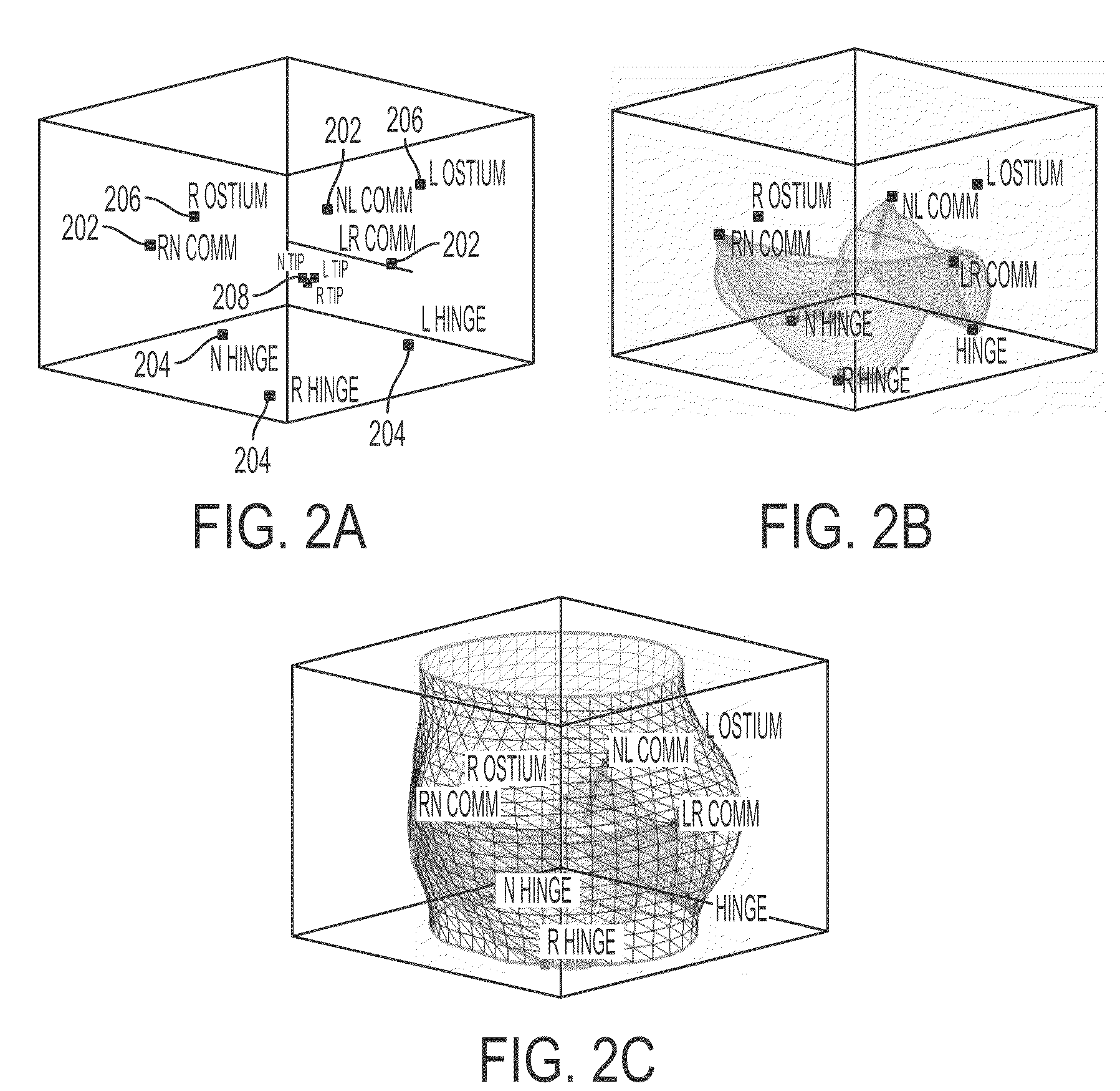 Method and system for automatic quantification of aortic valve function from 4D computed tomography data using a physiological model