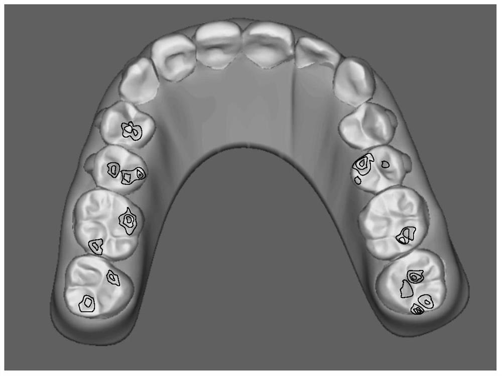 Method for monitoring the status of orthodontics