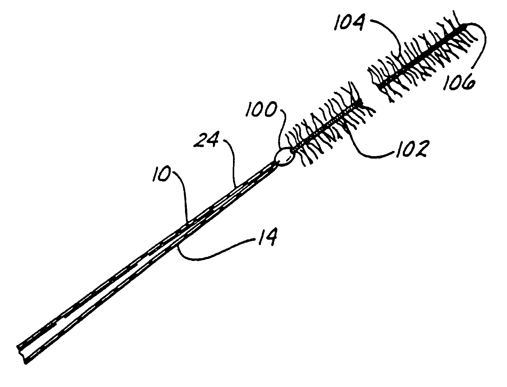 Endovascular electrolytically detachable wire and tip for the formation of thrombus in arteries, veins, aneurysms, vascular malformations and arteriovenous fistulas