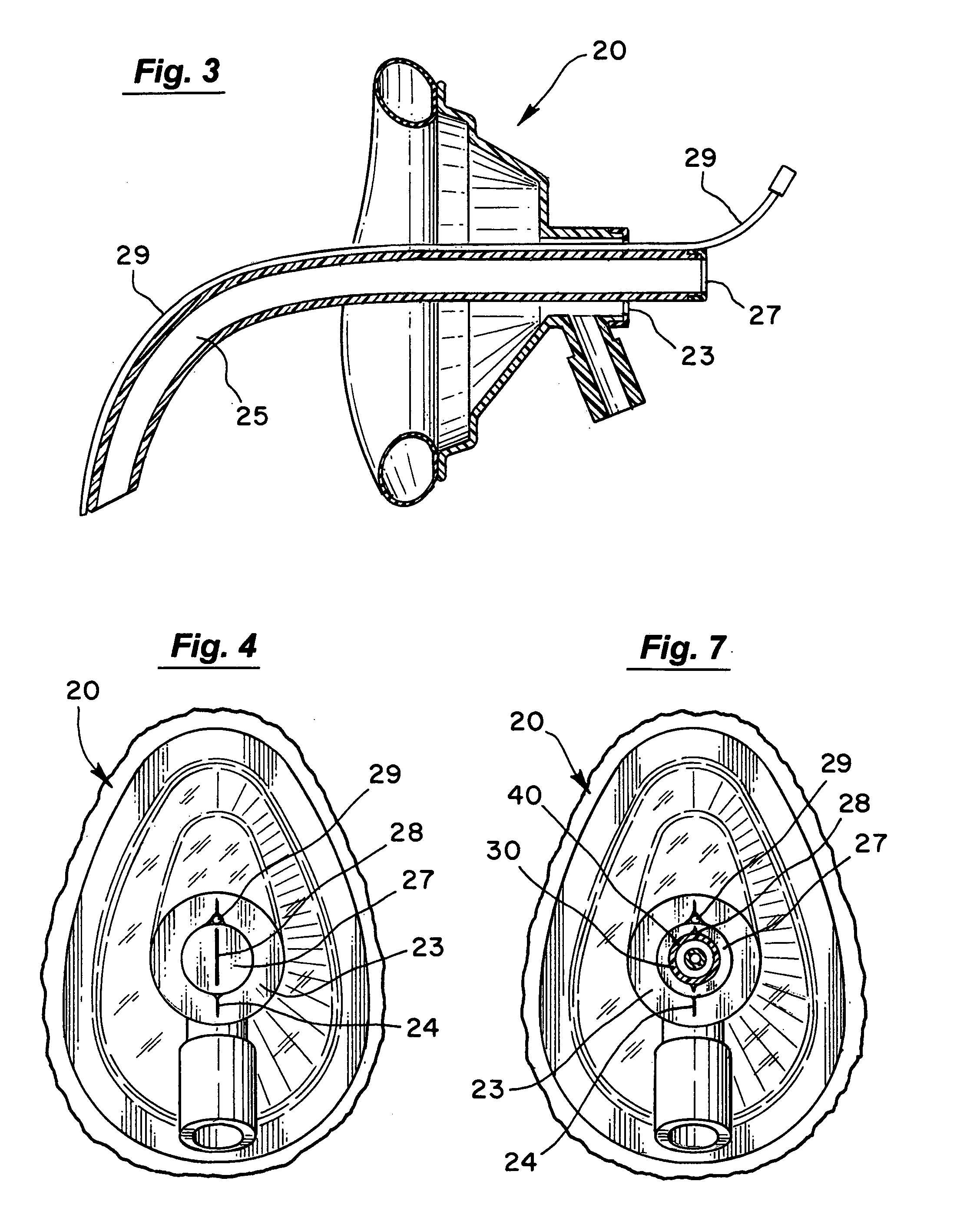 Method and apparatus for ventilation / oxygenation during guided insertion of an endotracheal tube