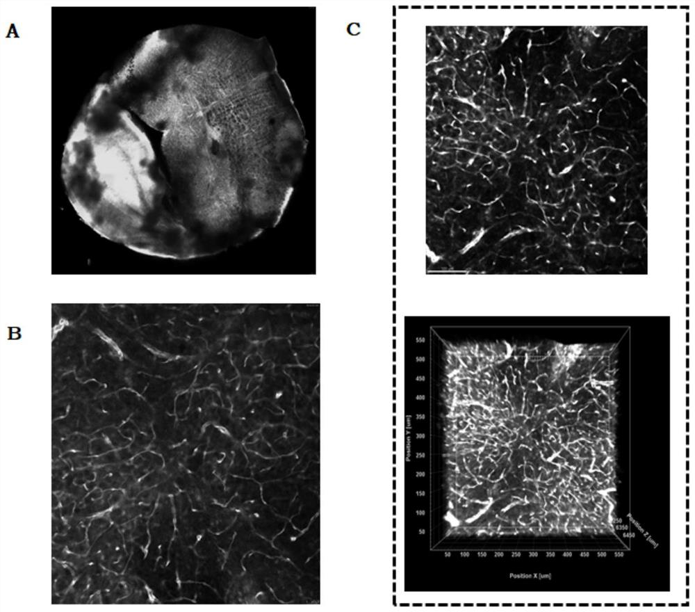 Application of combination of tissue transparentizing method and histological method to detection of bacteria in tumor