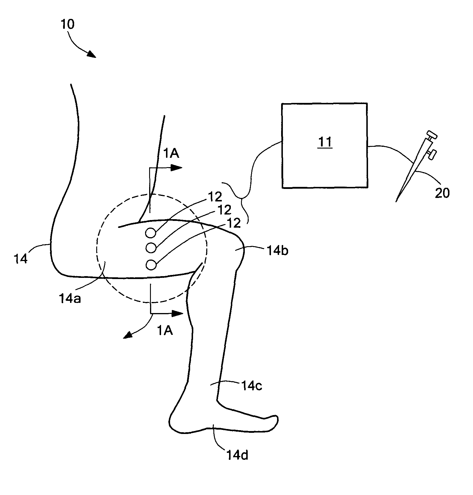 Interactive system and method for peripheral nerve mapping and blocking