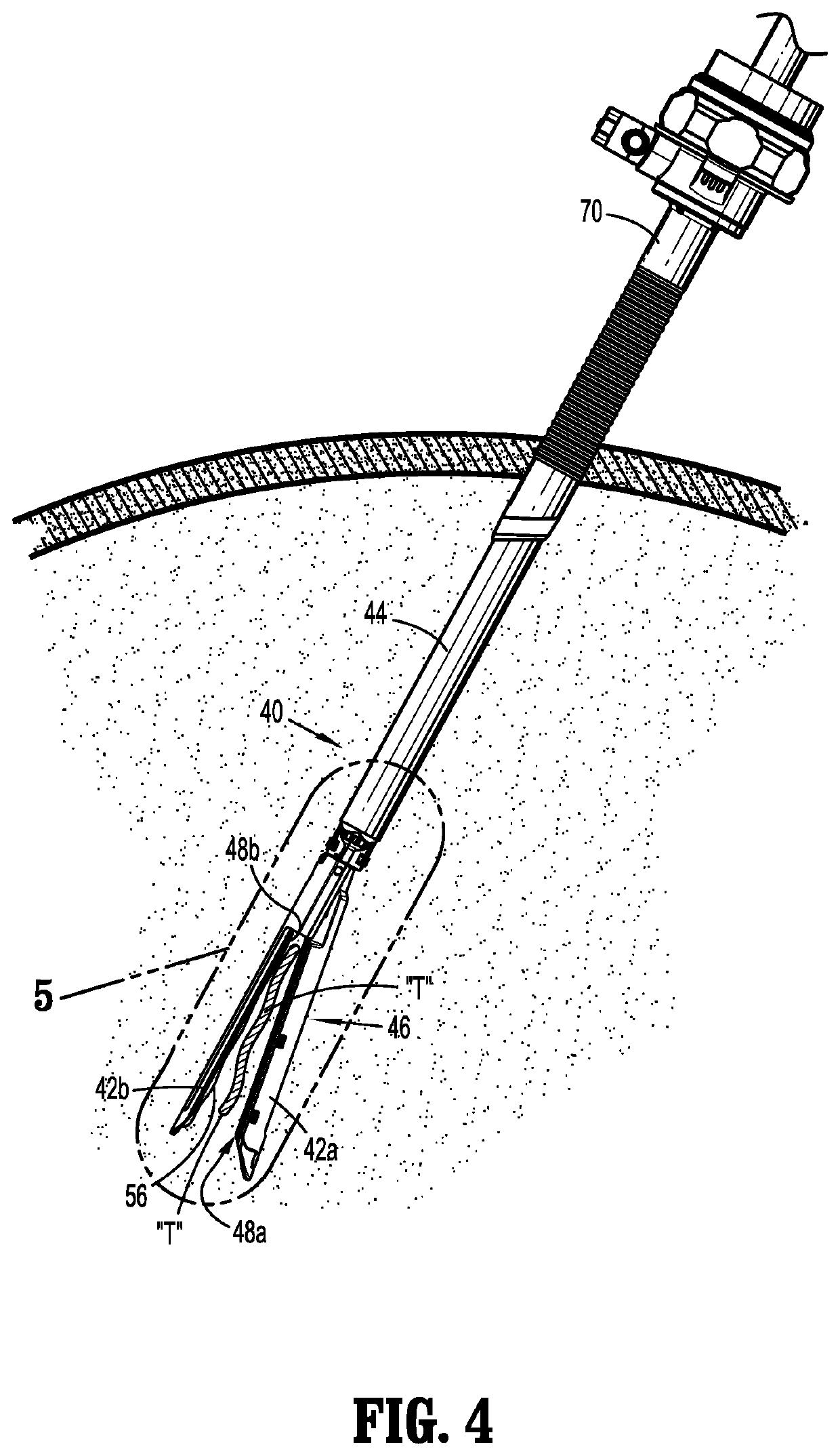 Surgical instruments including sensors