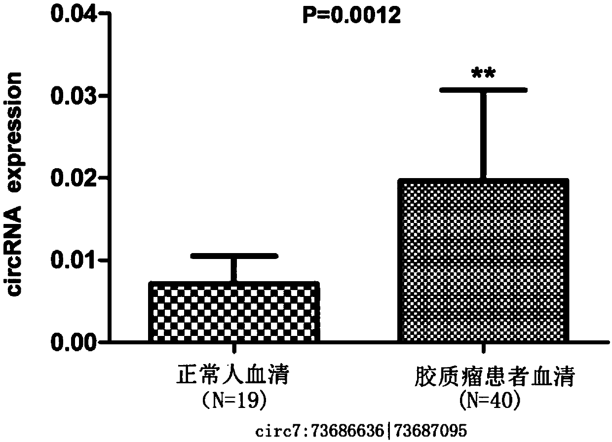 Glioma prognostic marker circ7:73686636|73687095 and application