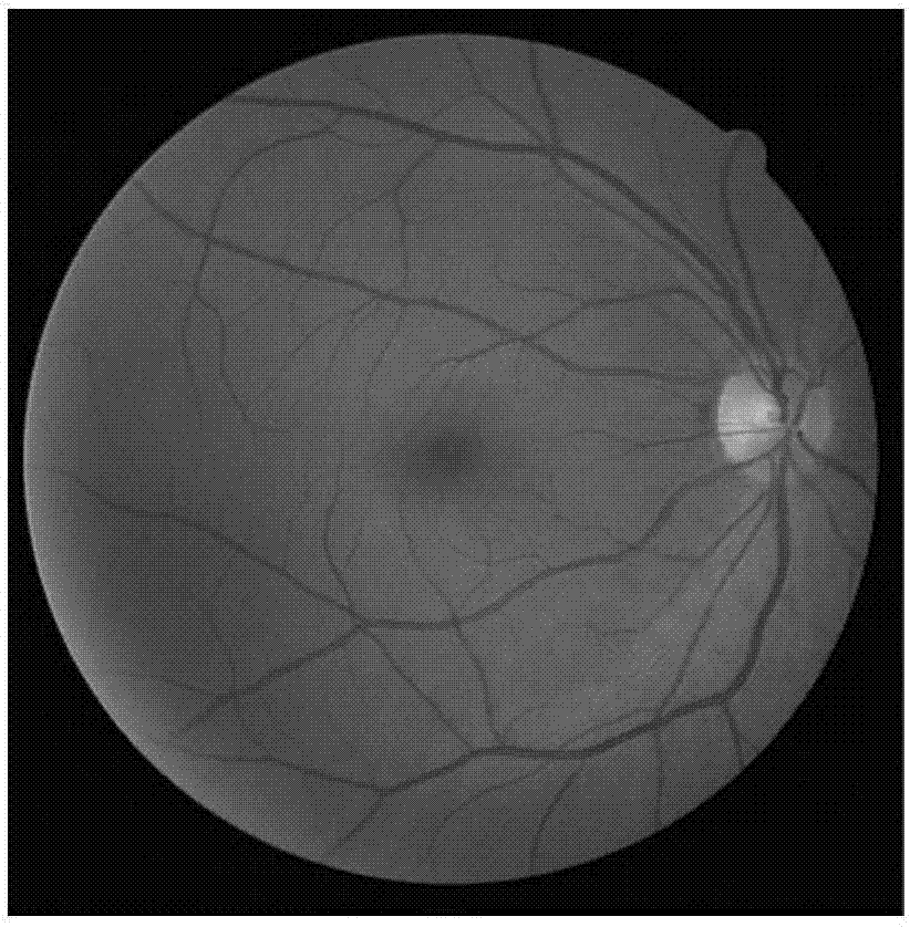 Retinal Vessel Extraction Method and System Based on Dynamic Scale Allocation