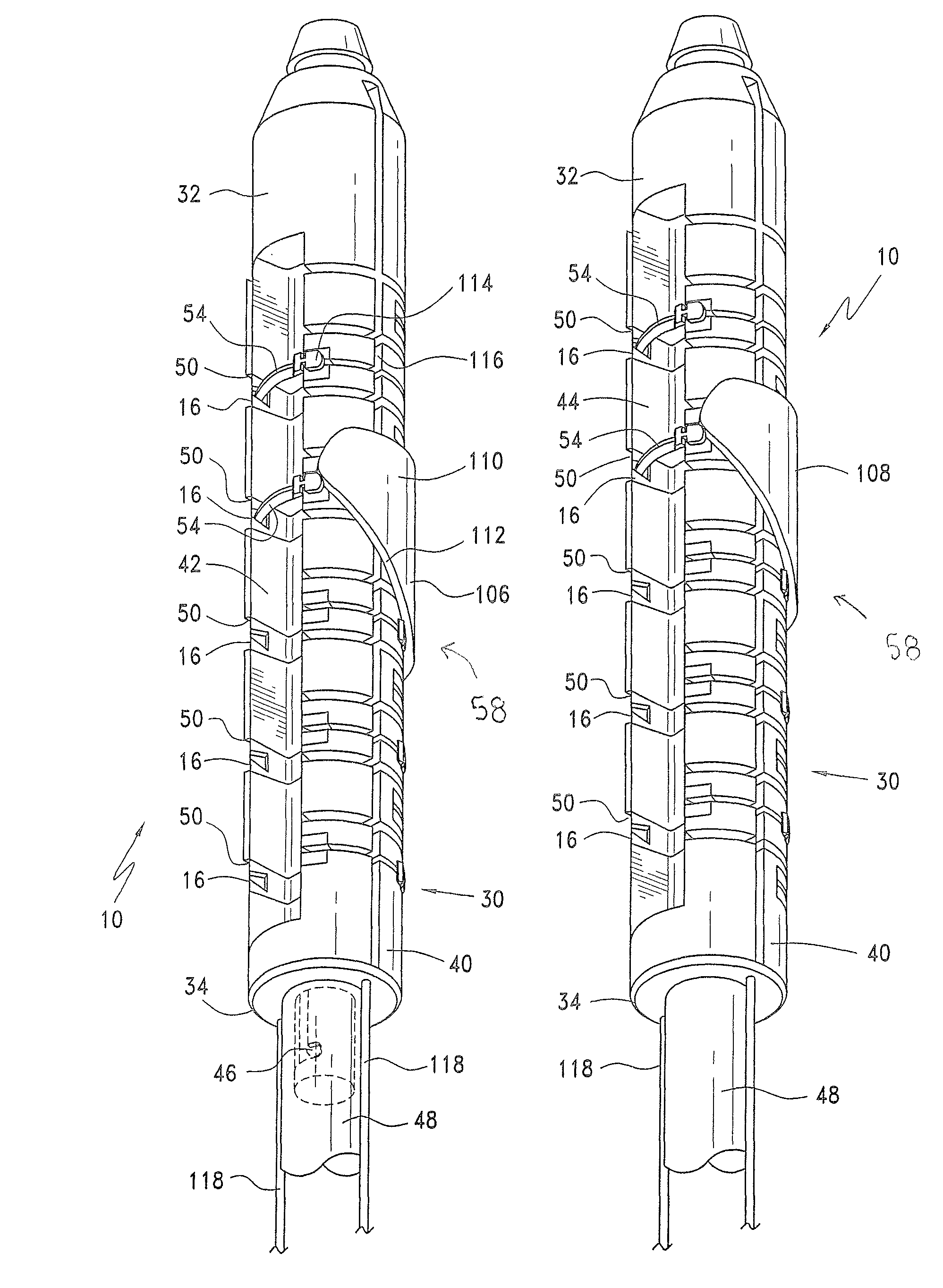 Method and apparatus for endoscopically performing gastric reduction surgery in a single step