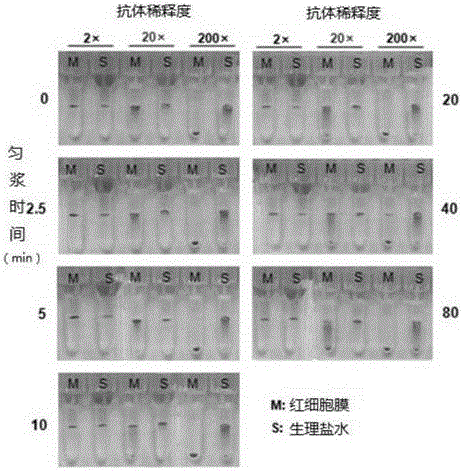 Erythrocyte membrane, and preparation method and application thereof