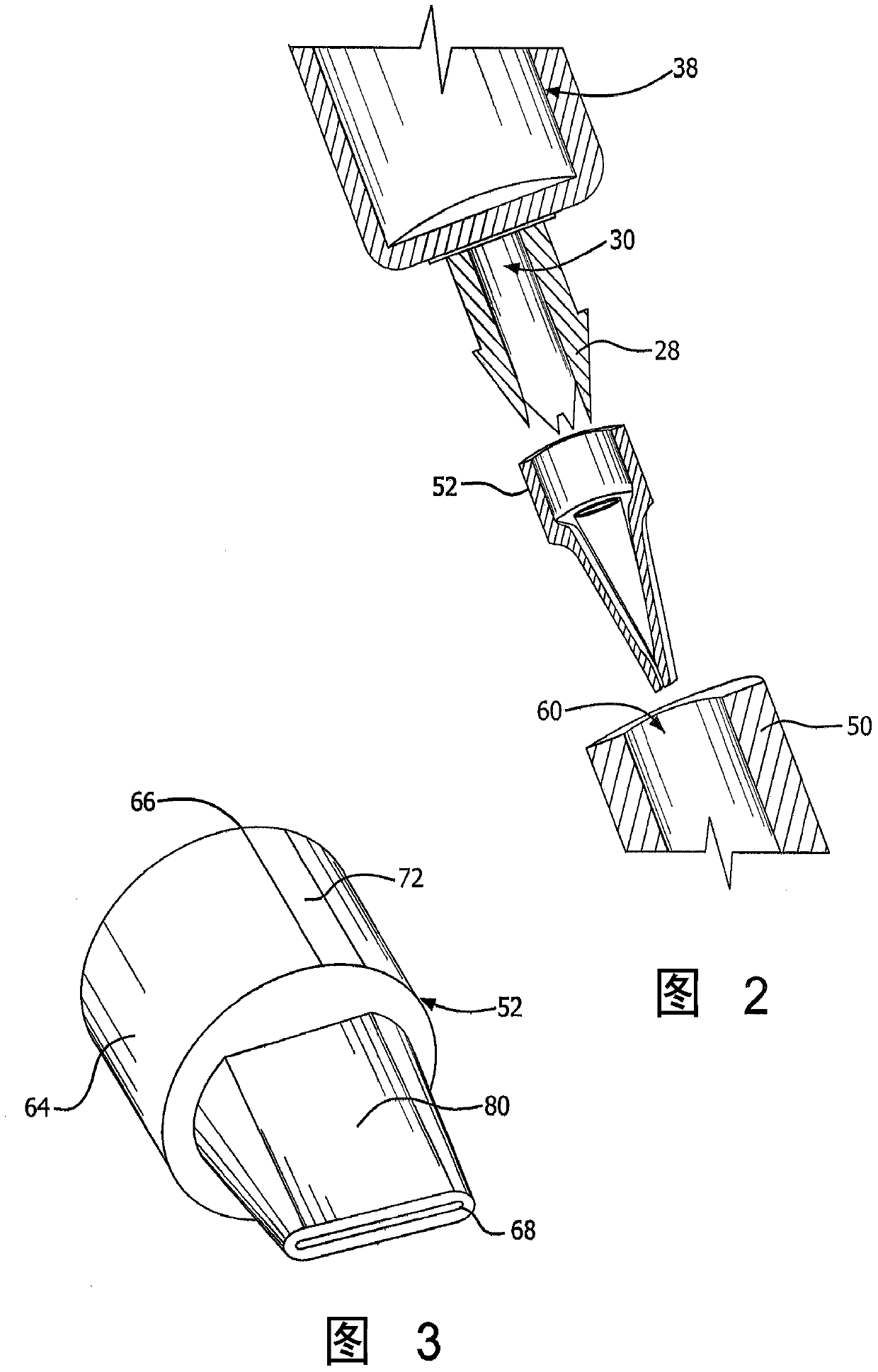 ventilation system