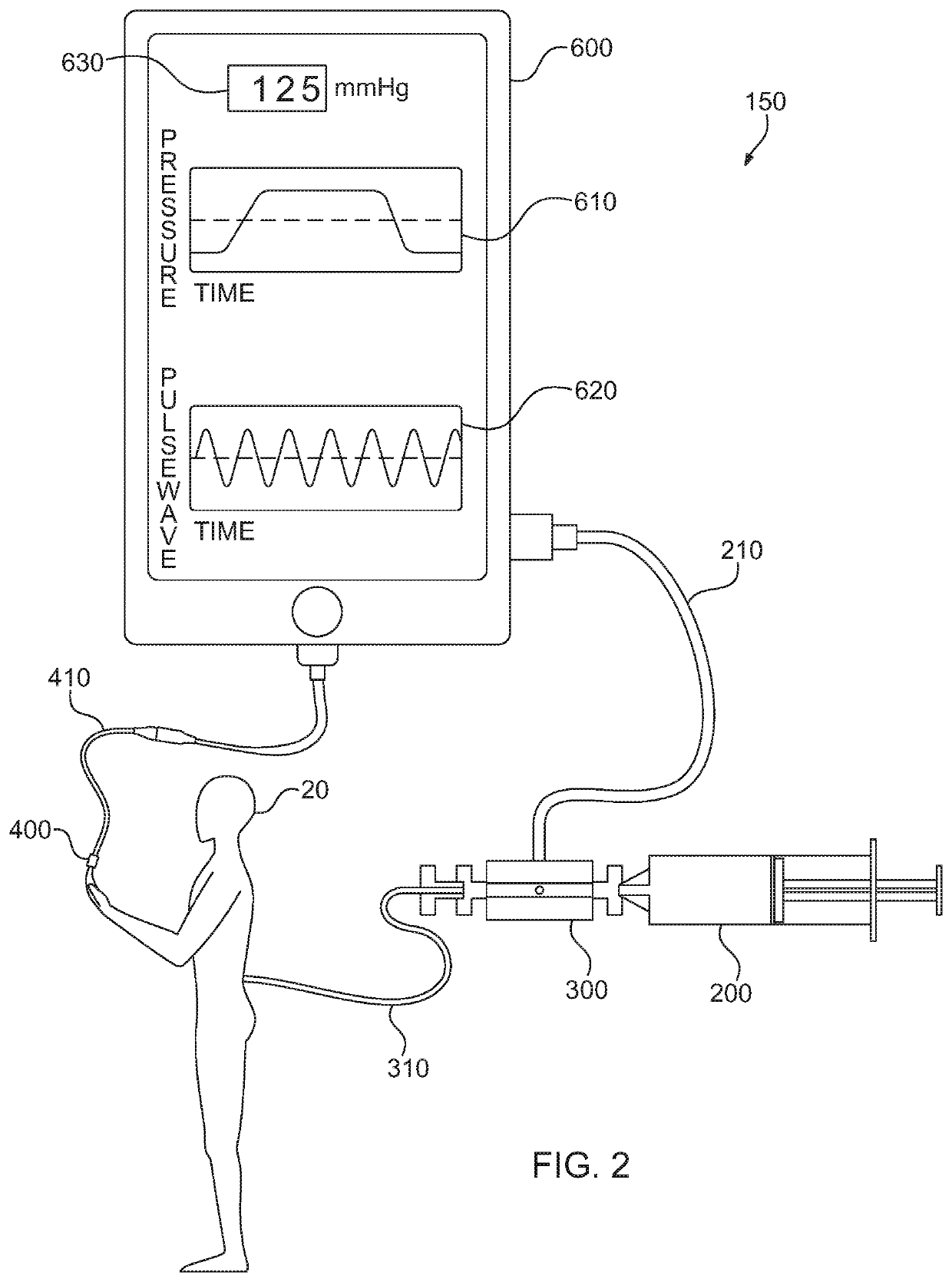 Device and Method for Needle/Catheter Location Utilizing Correlation Analysis