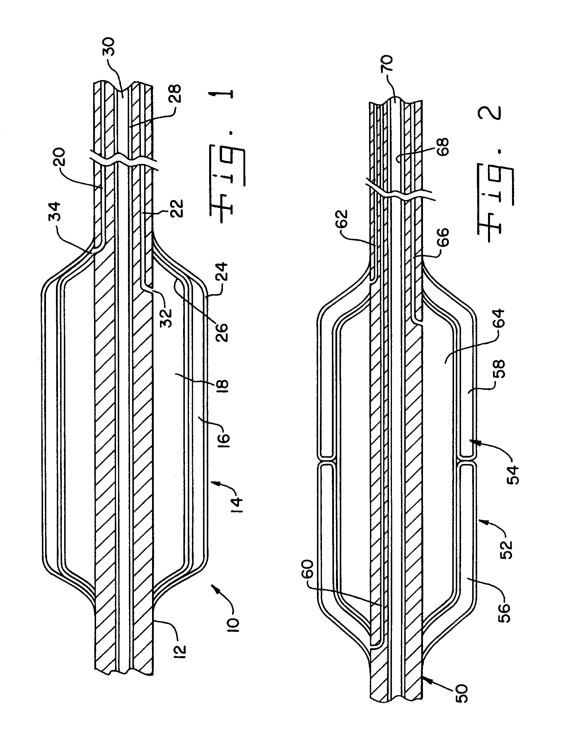 Catheter with concentric balloons for radiogas delivery and booster radiosources for use therewith