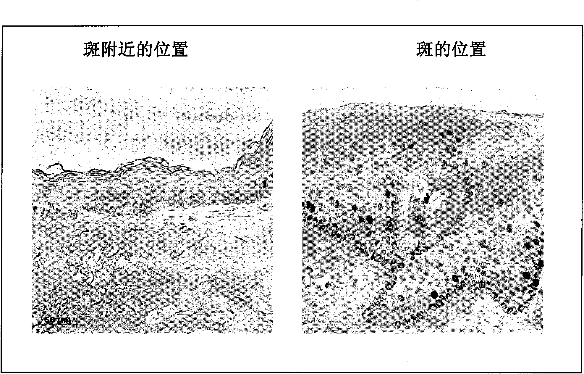 Method of evaluating or selecting agents for preventing or improving pigmented spots