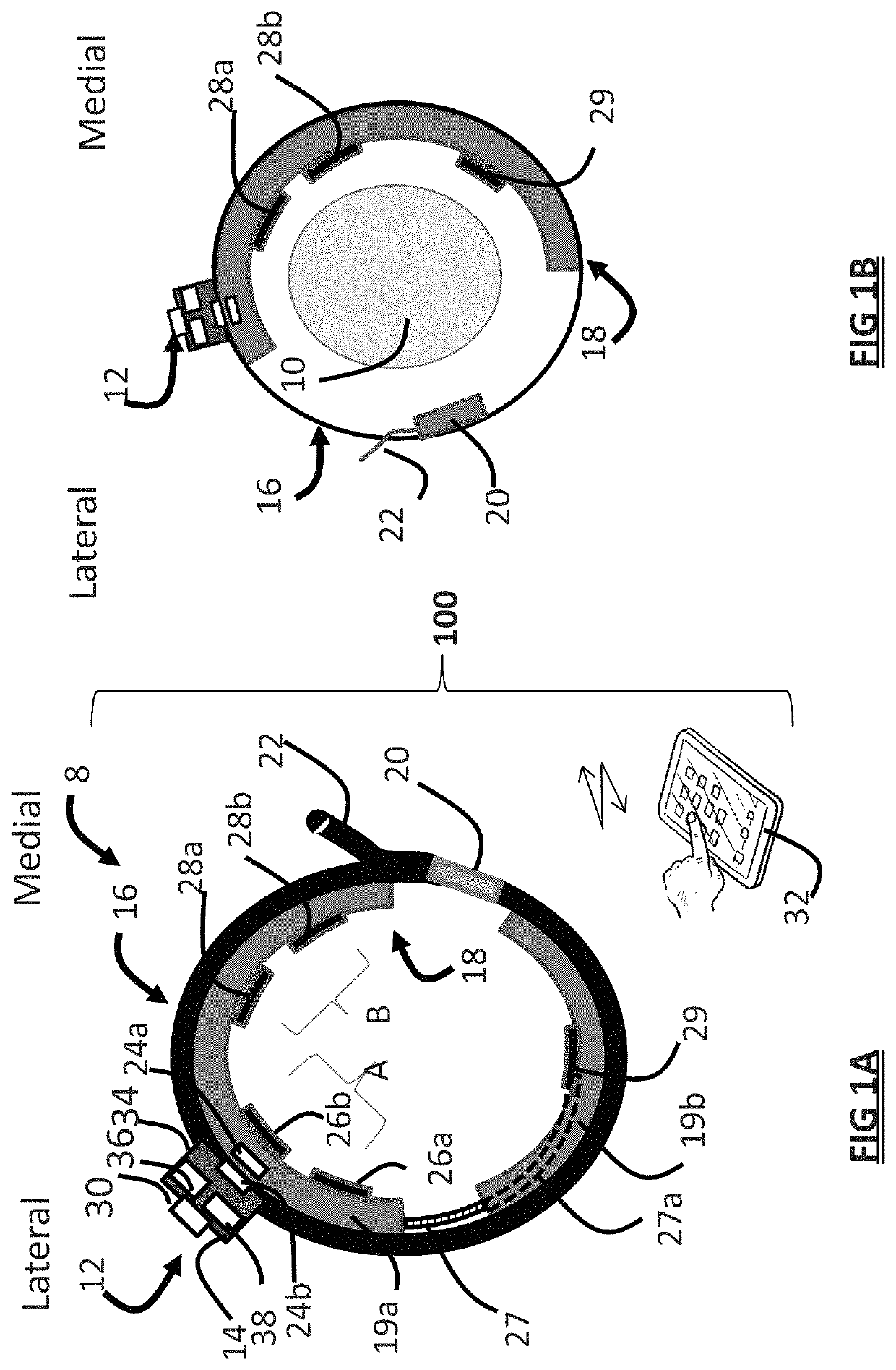 Systems and methods for assessing pelvic floor disorder therapy