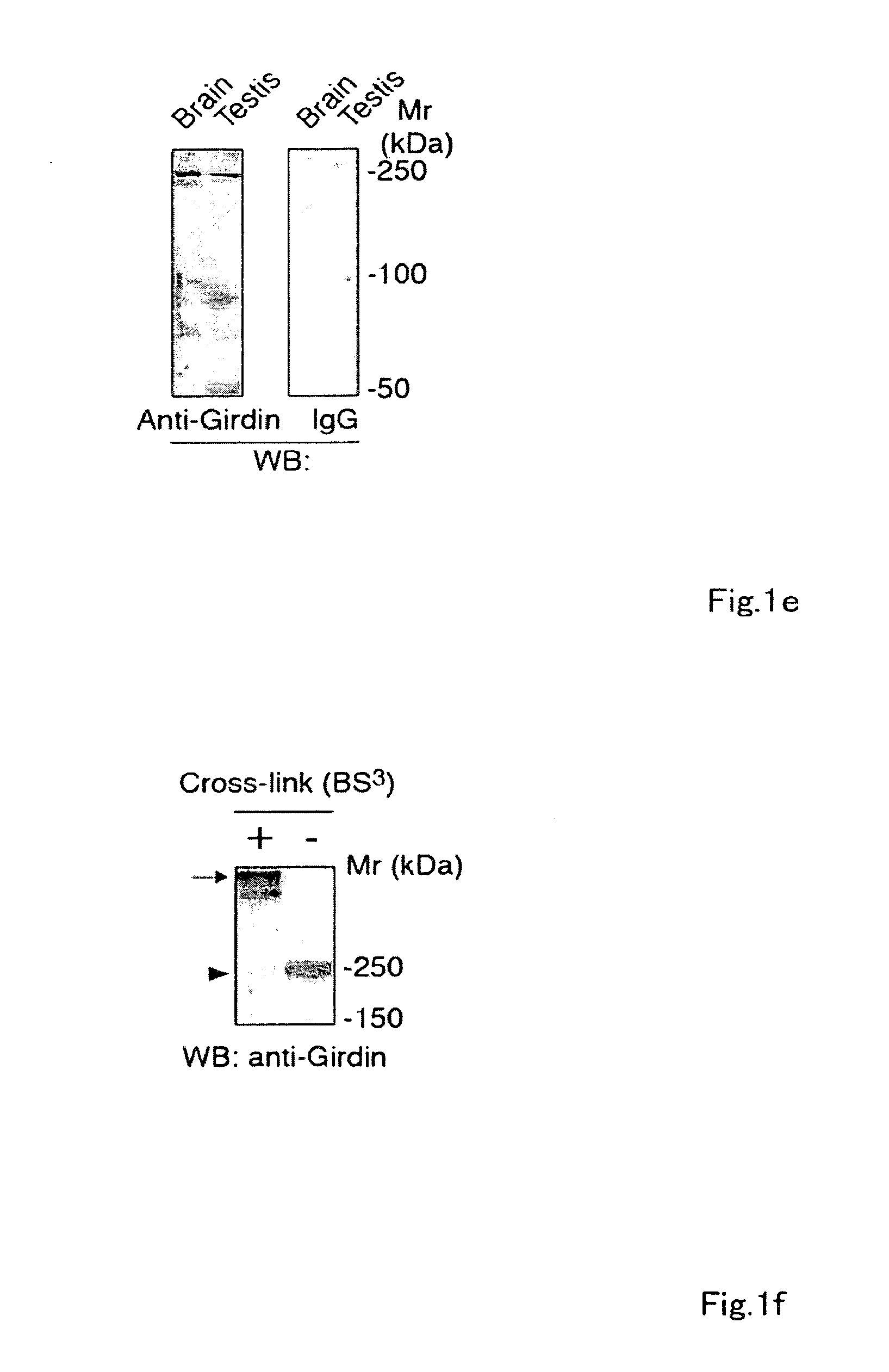 Antibodies against actin-binding protein girdin and methods of making and using the same