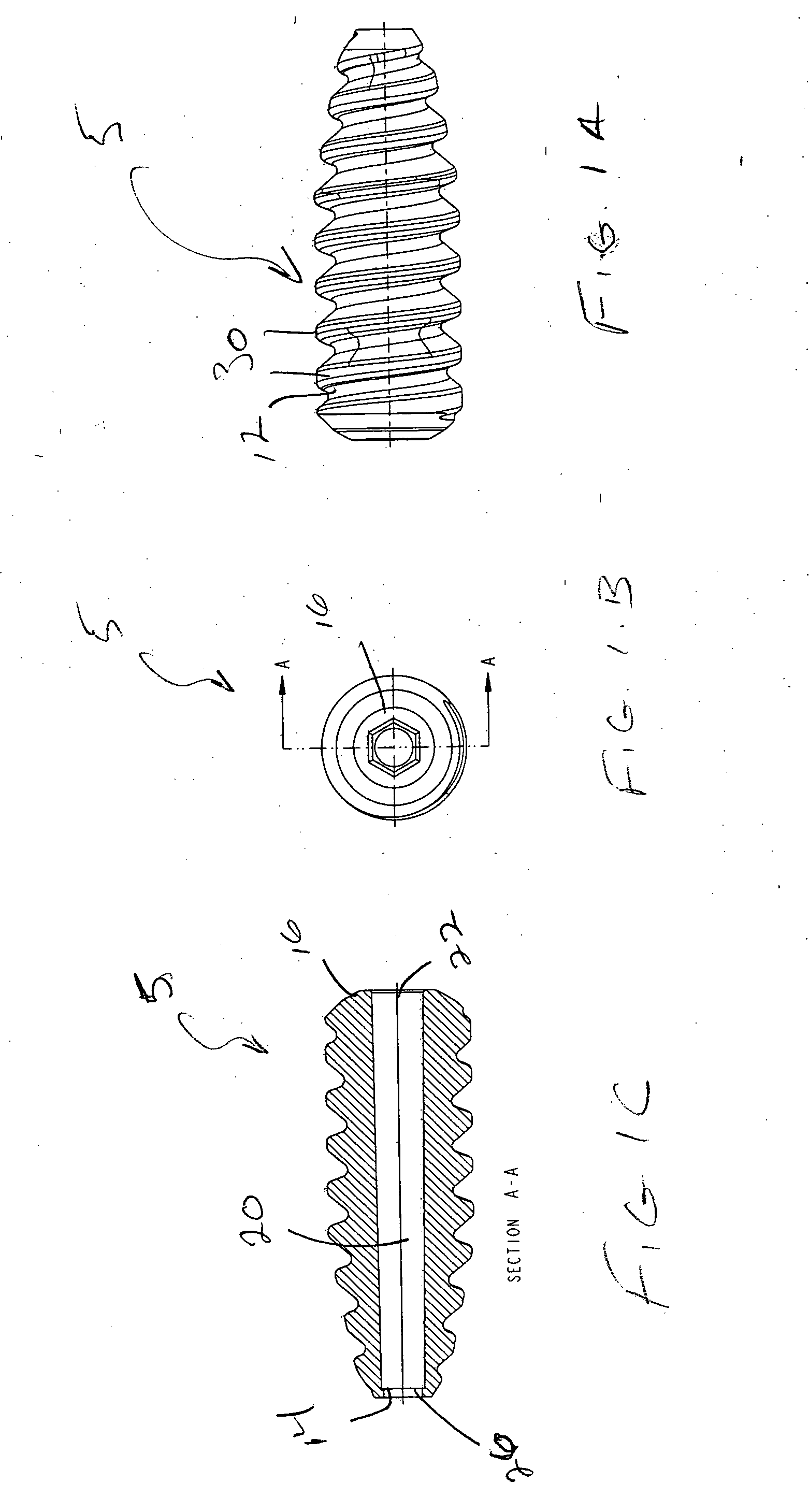 Method of performing anterior cruciate ligament reconstruction using biodegradable interference screw
